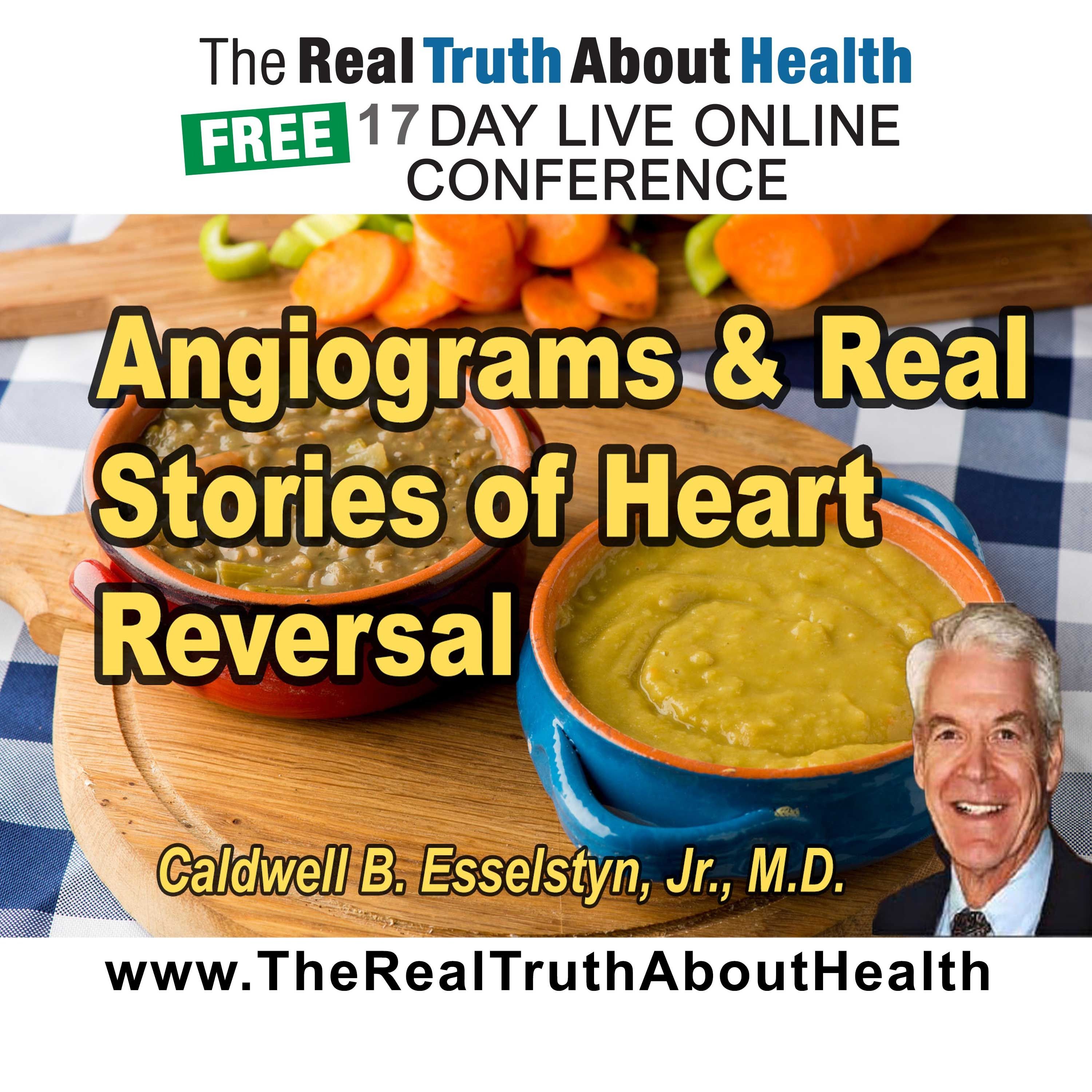 Angiograms and real stories of heart reversal