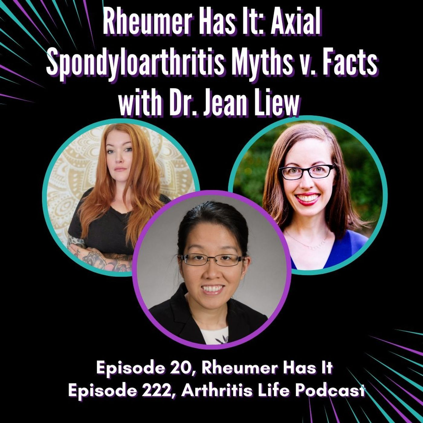 Rheumer Has It: Axial Spondyloarthritis Myths v. Facts with Dr. Jean Liew Rheumer Has It: Axial Spondyloarthritis Myths v. Facts with Dr. Jean Liew