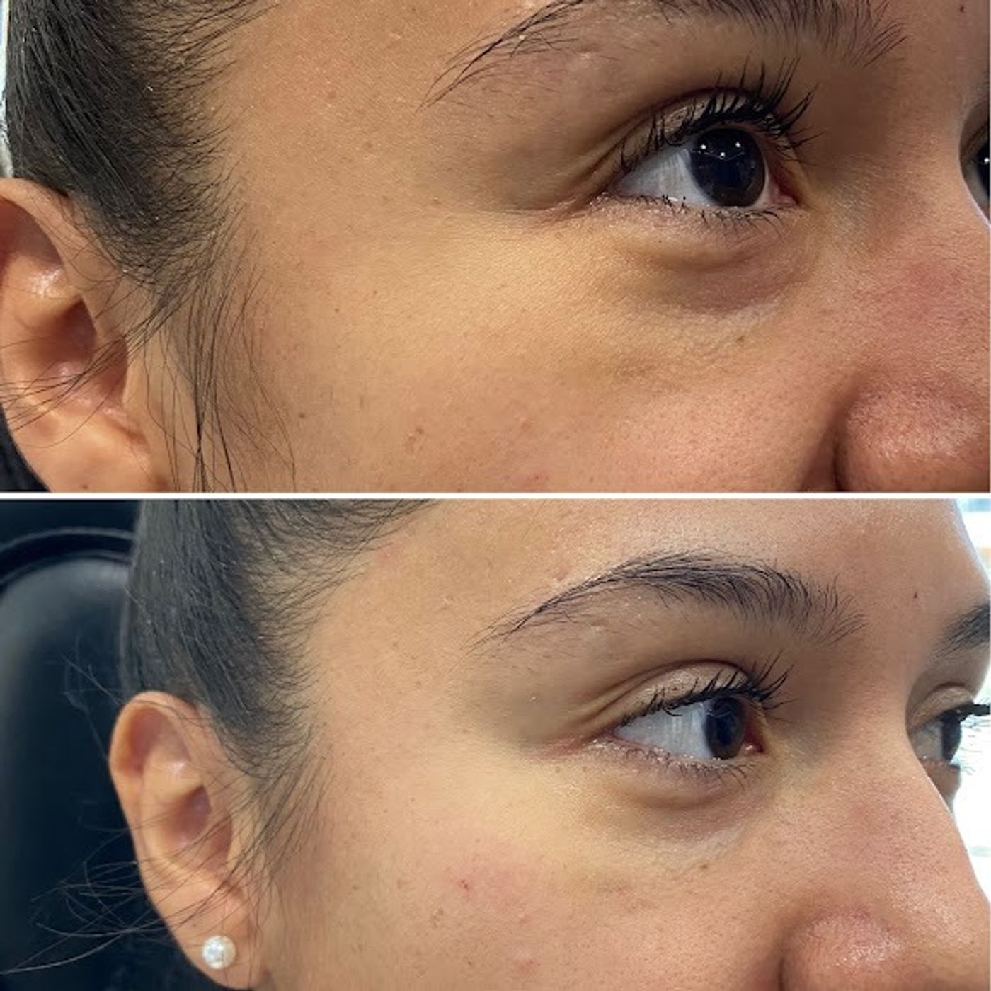 Flawless Faces Med Spa Chandler | Botox, Lip Fillers And Laser Hair Removal