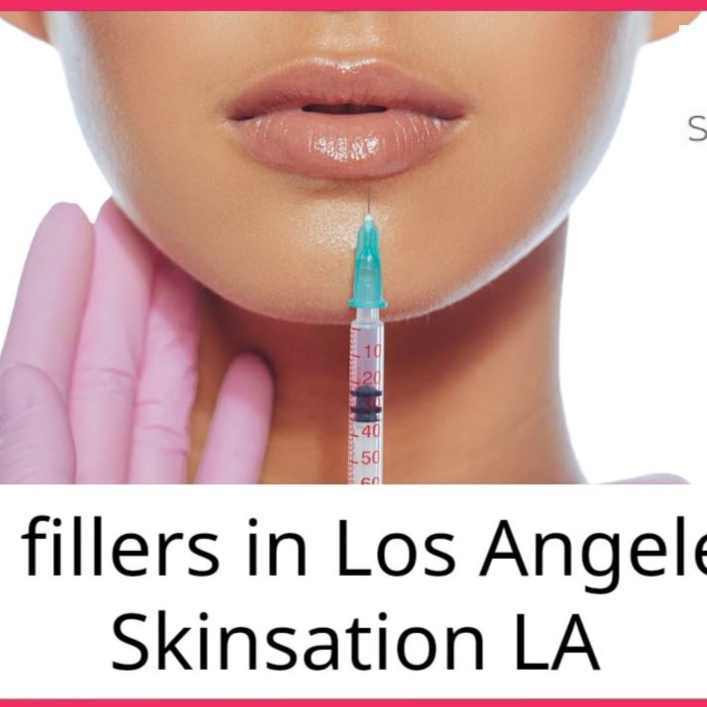 Skin Tightening, Botox and Lip Fillers by Skinsation LA