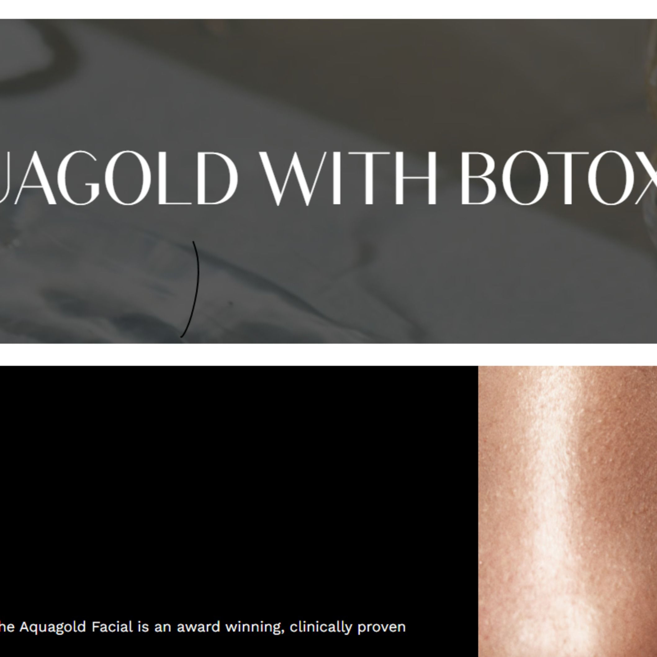 Skin Tightening, Botox and Lip Fillers by Skinsation LA