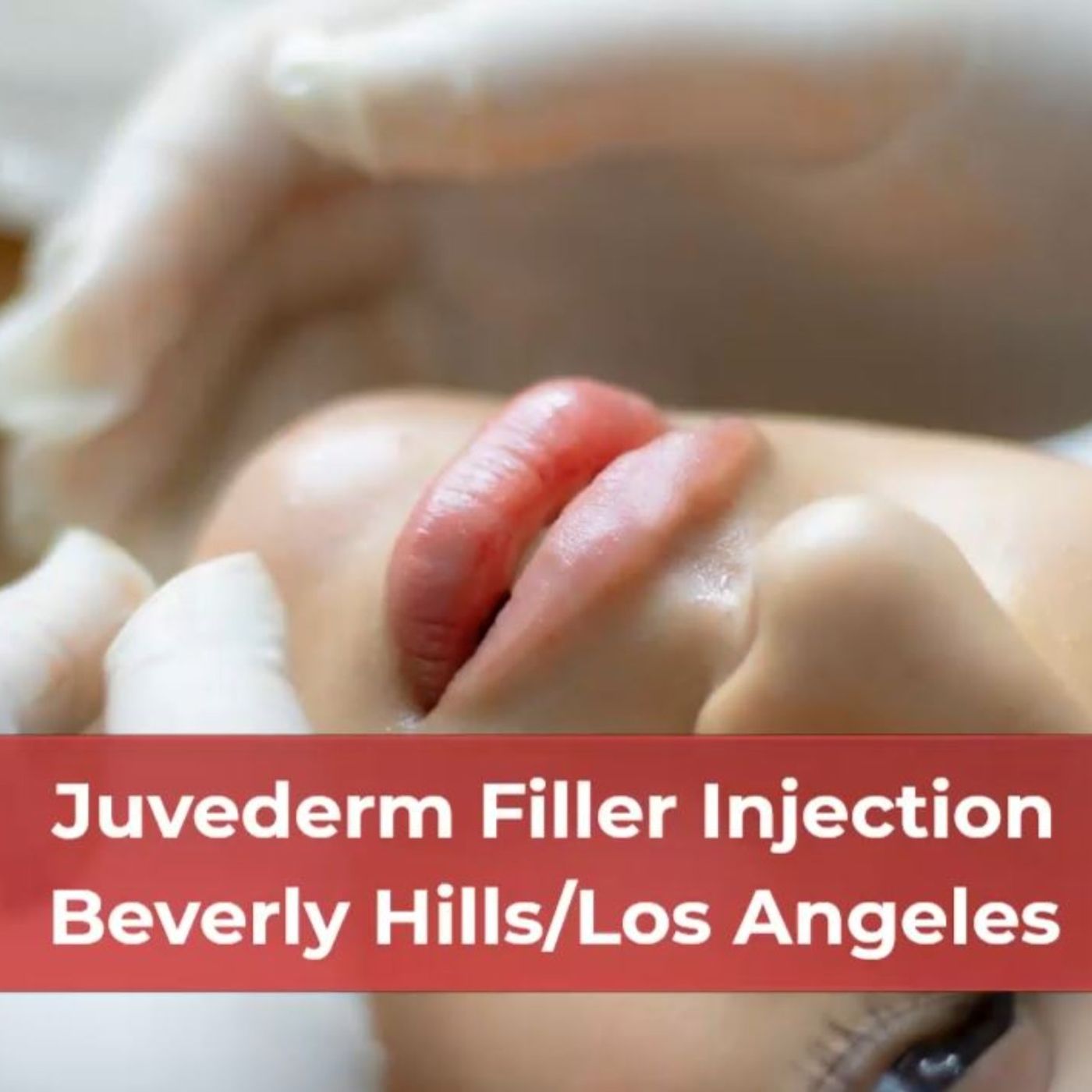 Skin Tightening, Botox and Lip Fillers by Skinsation LA