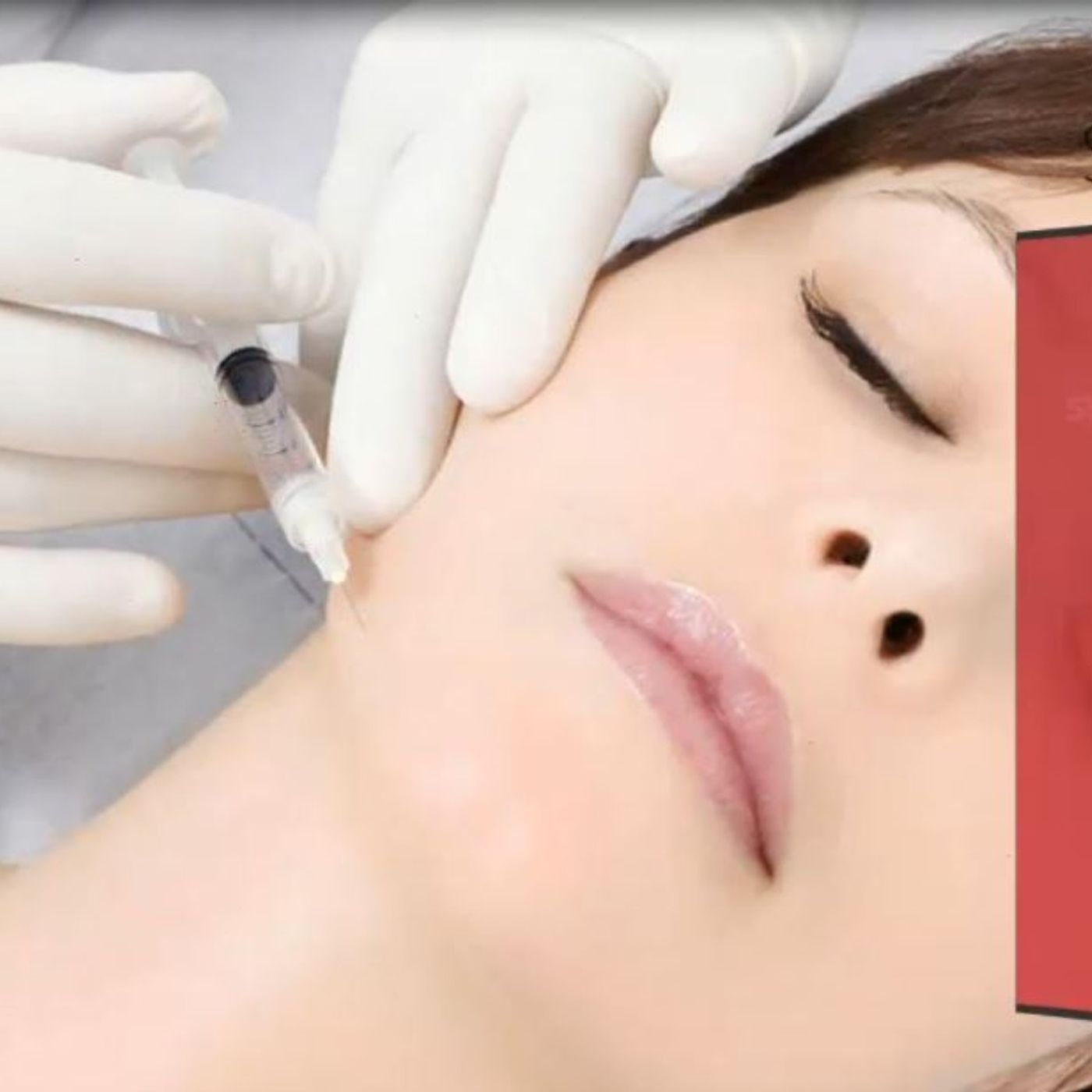 Skin Tightening, Botox and Lip Fillers by Skinsation LA