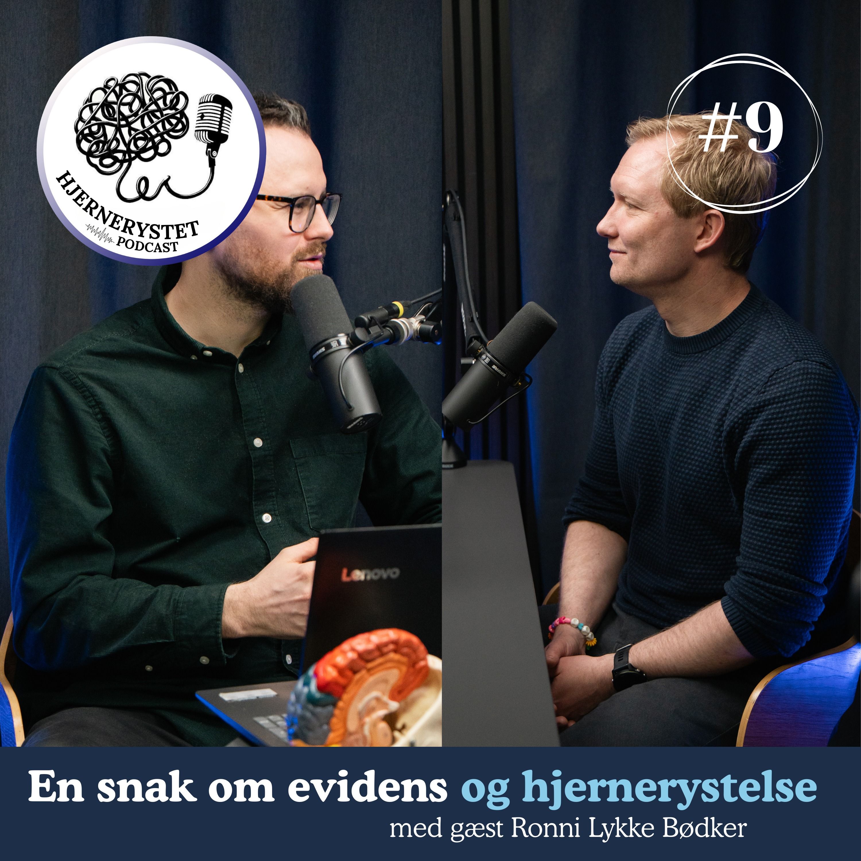 Hjernerystet