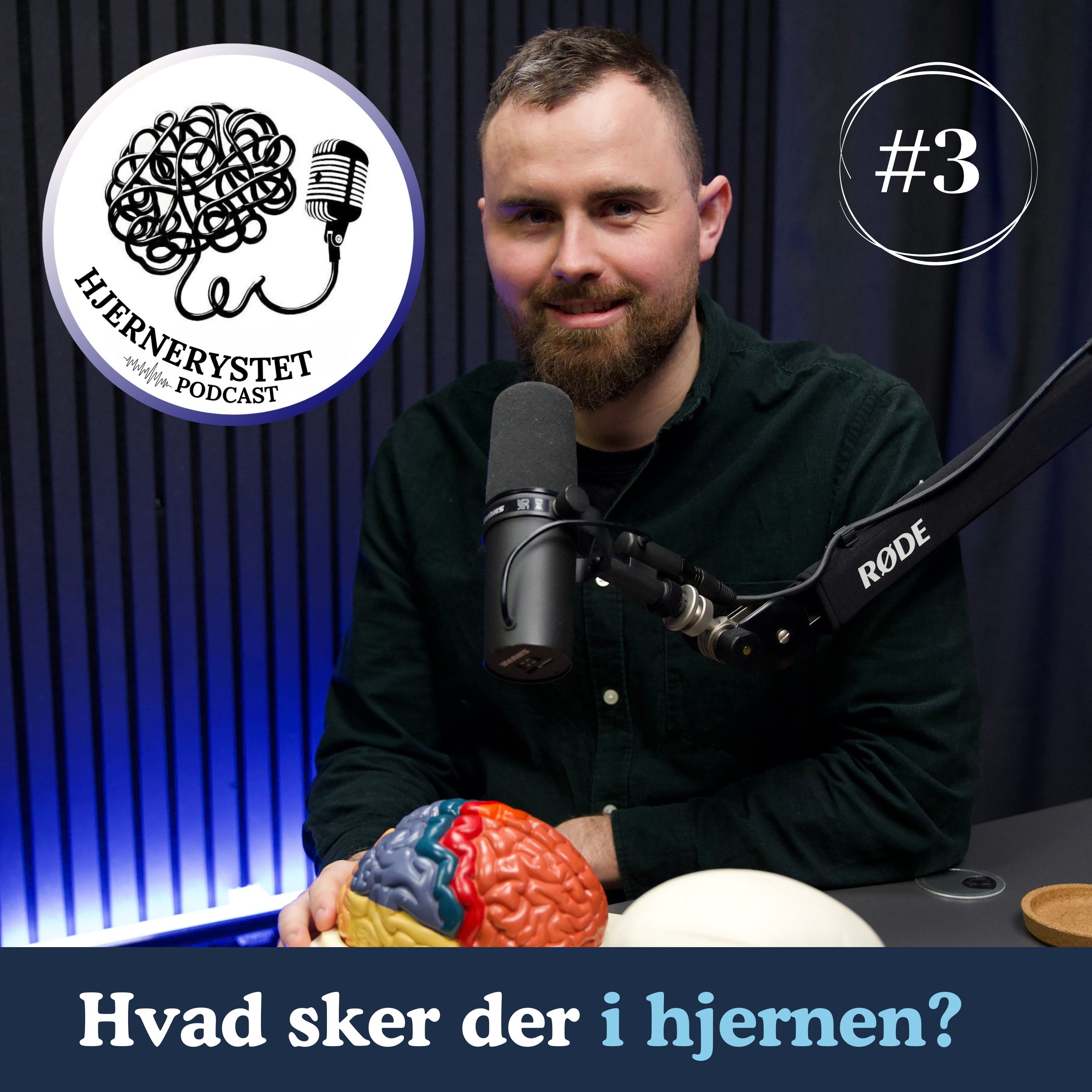 Hjernerystet