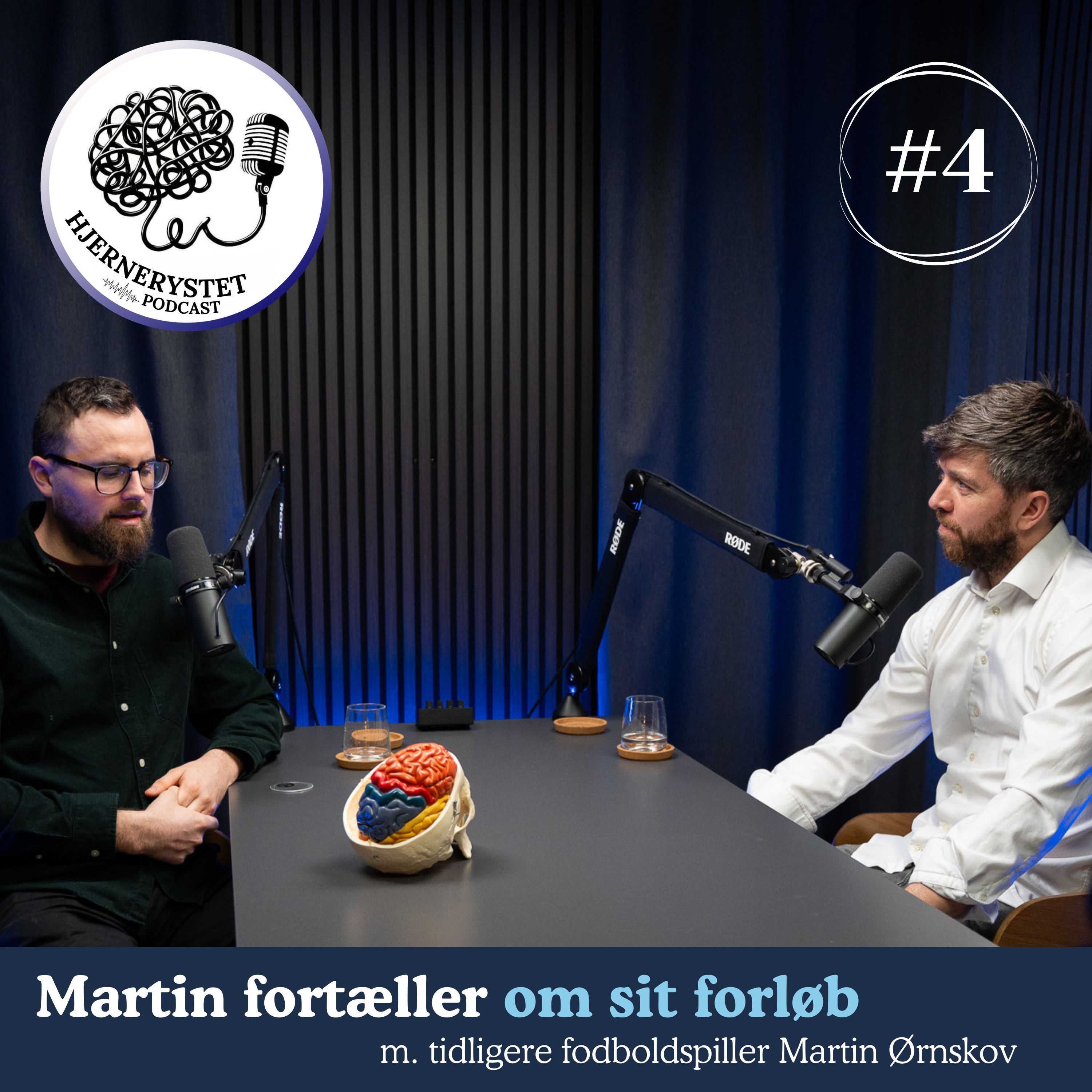 Hjernerystet