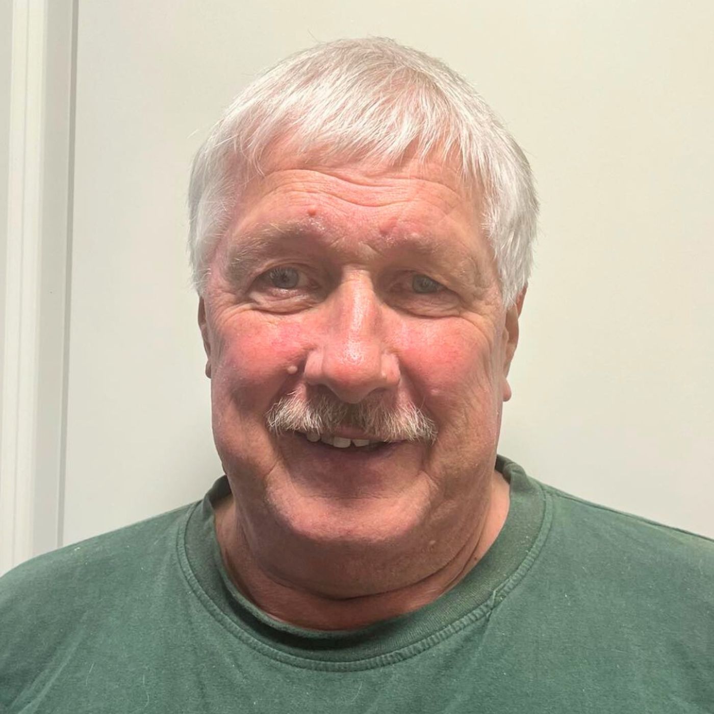 Episode 404: He Had Stage 4 Liver Cancer and Cirrhosis of the Liver