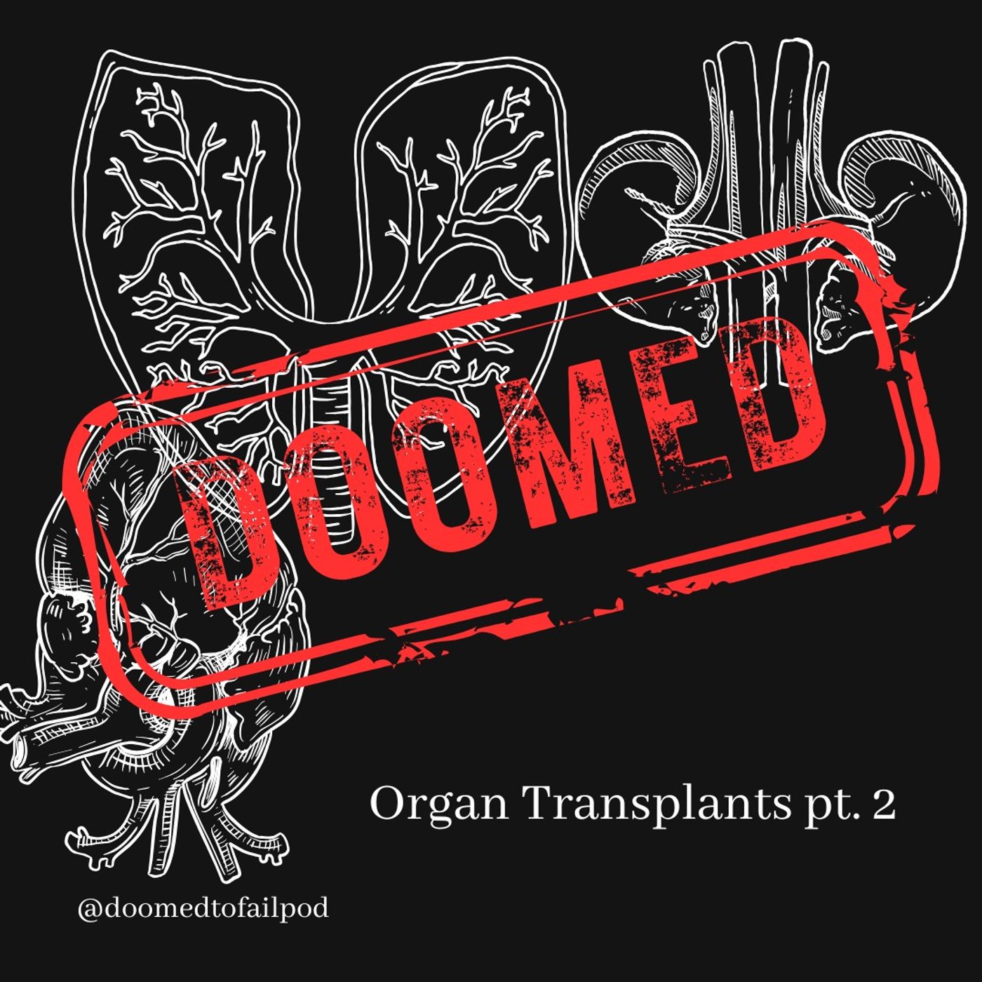 Ep 201: The Living Market - Organ Transplants Pt 2