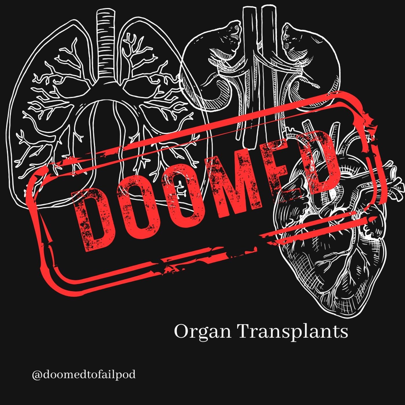 Ep 198: I'll take one of those! - Organ Transplants pt 1