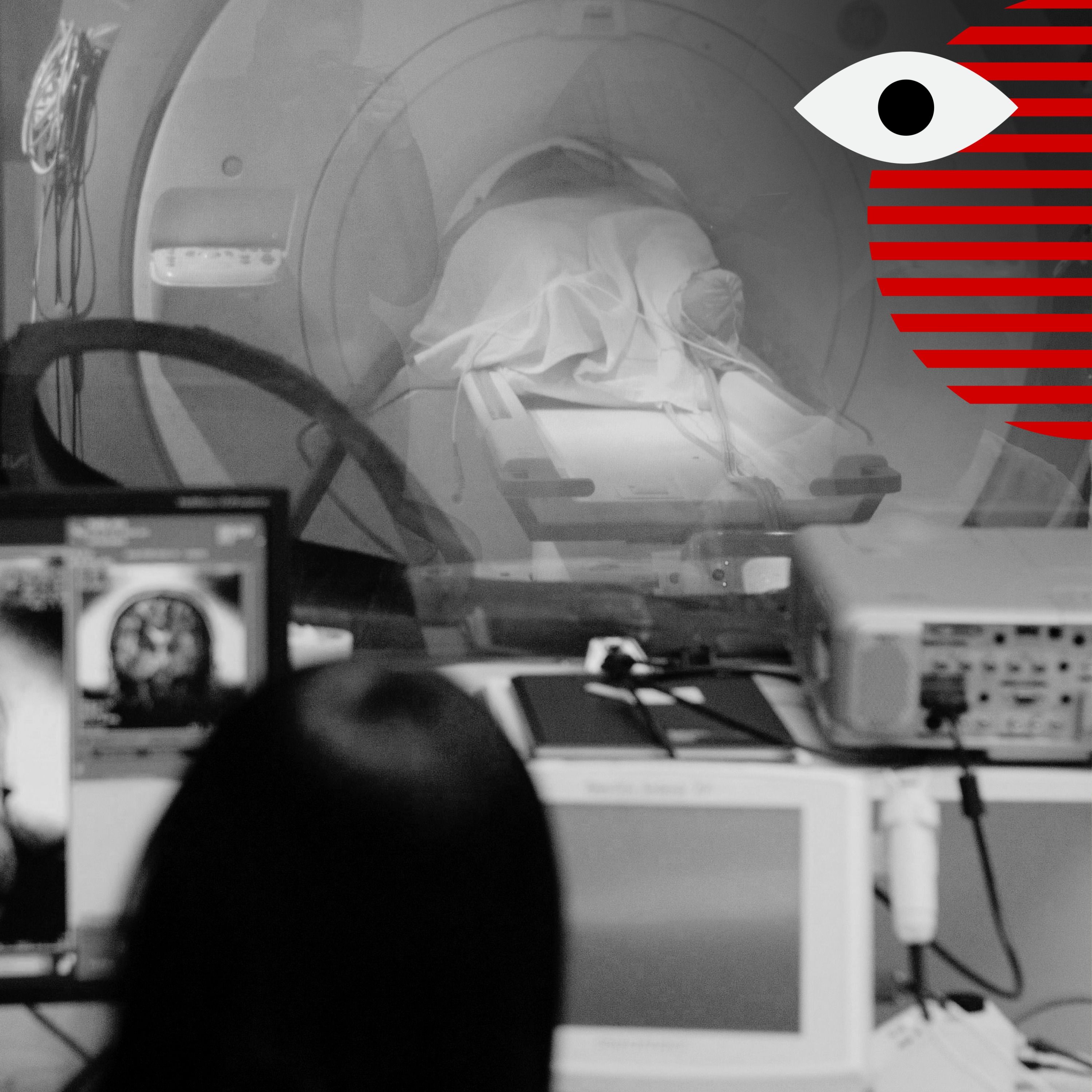 Scan or scam: Are elective full-body MRI's worth it?