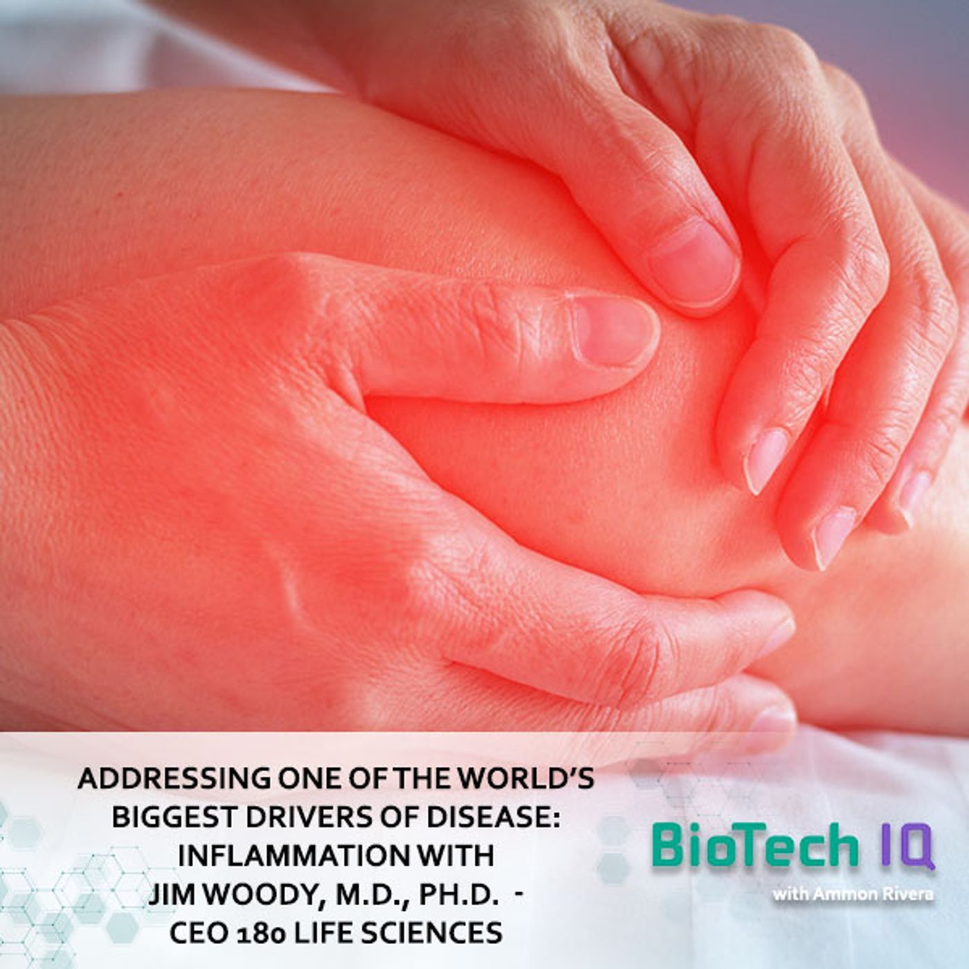 Addressing One Of The World’s Biggest Drivers Of Disease: Inflammation With Jim Woody, M.D., Ph.D. - CEO 180 Life Sciences Addressing One Of The World’s Biggest Drivers Of Disease: Inflammation With Jim Woody, M.D., Ph.D. - CEO 180 Life Sciences