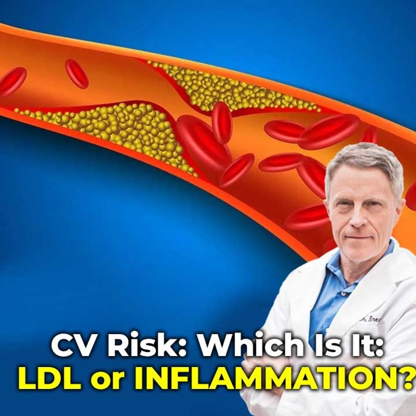 CV Risk: Which Is It: LDL or INFLAMMATION? - FORD BREWER MD MPH