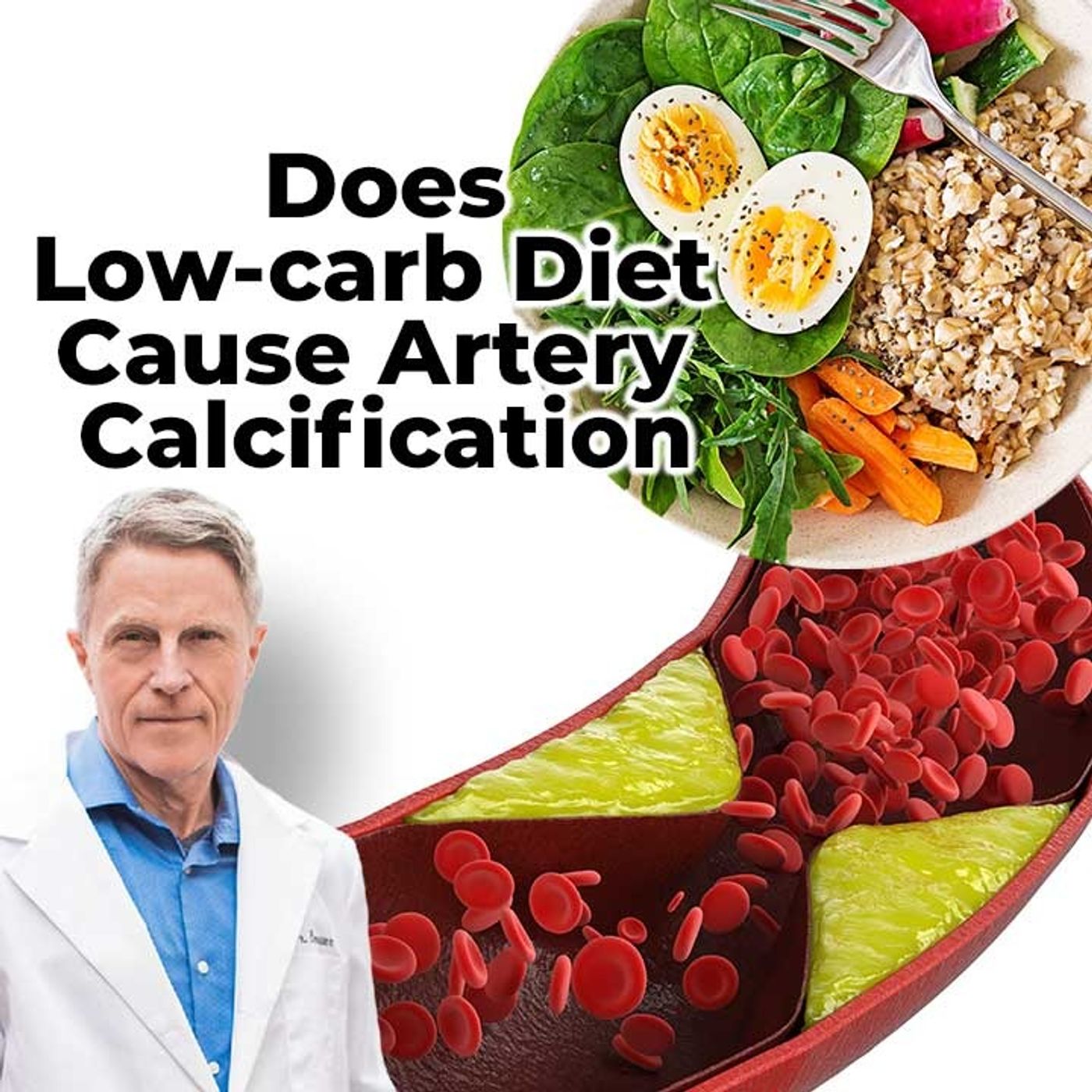 Does Low-carb Diet cause artery calcification? - FORD BREWER MD MPH