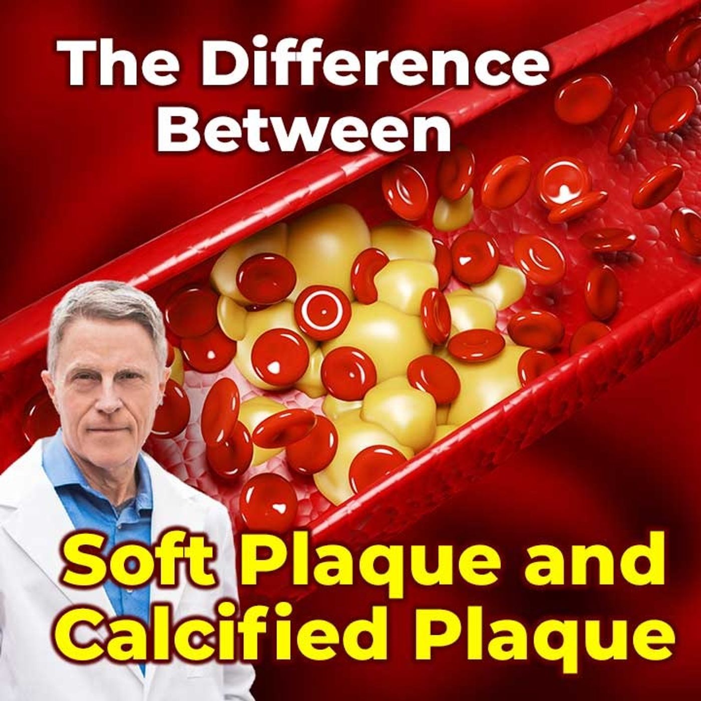 The Difference between Soft plaque and Calcified plaque - FORD BREWER MD MPH