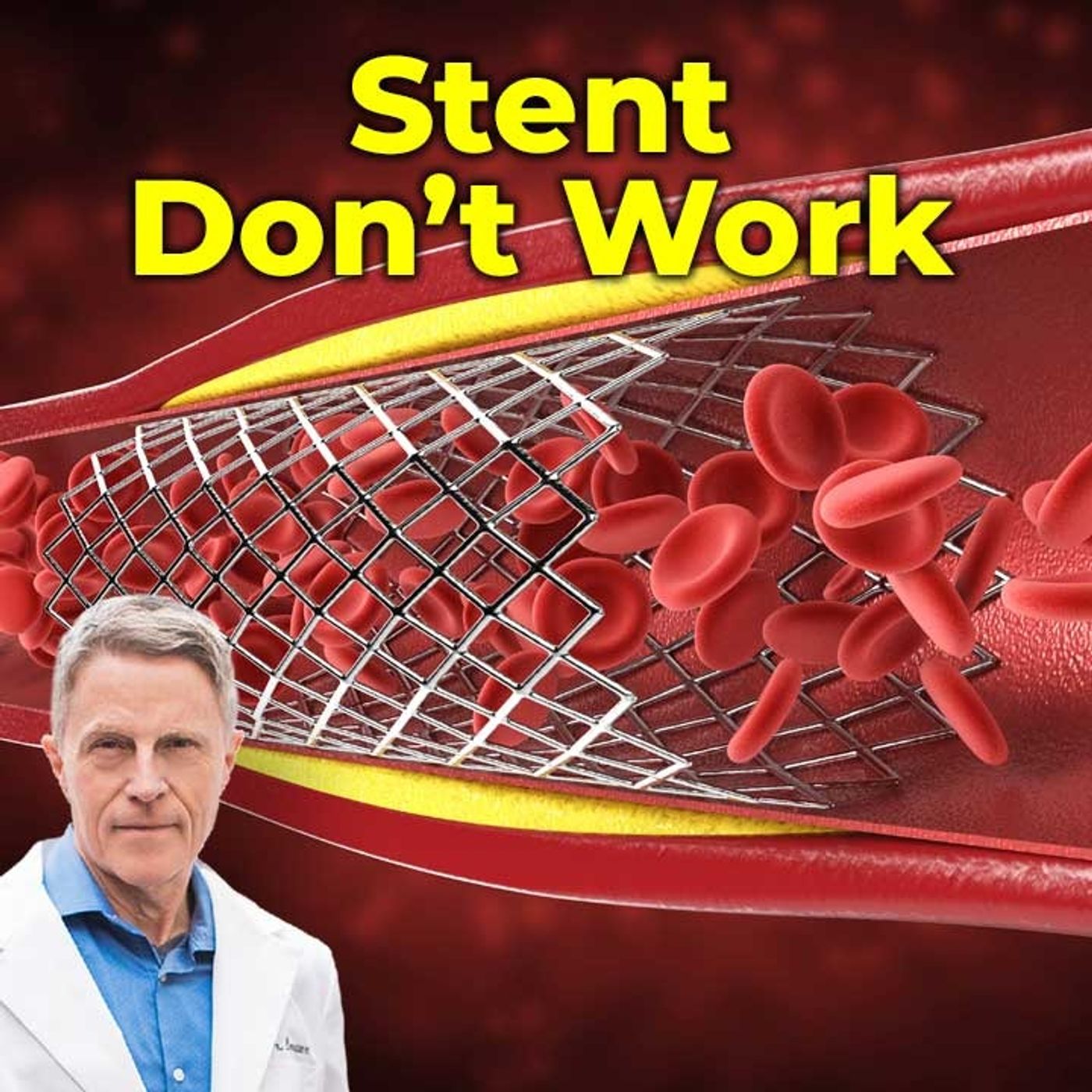 Do you know how to Prevent a Heart Attack? Hint: You don't need a Stent - FORD BREWER MD MPH
