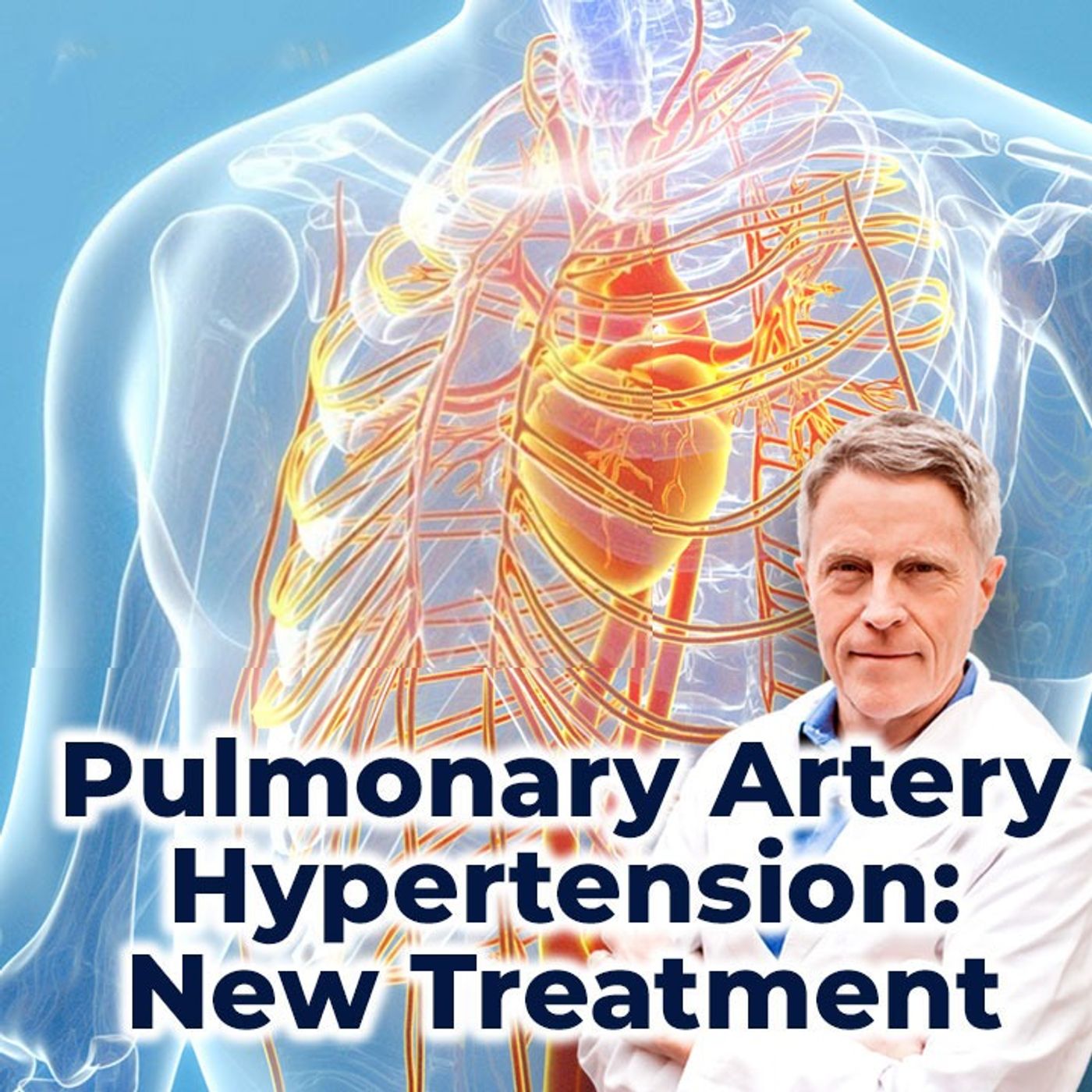 Pulmonary Artery Hypertension: New Treatments - FORD BREWER MD MPH
