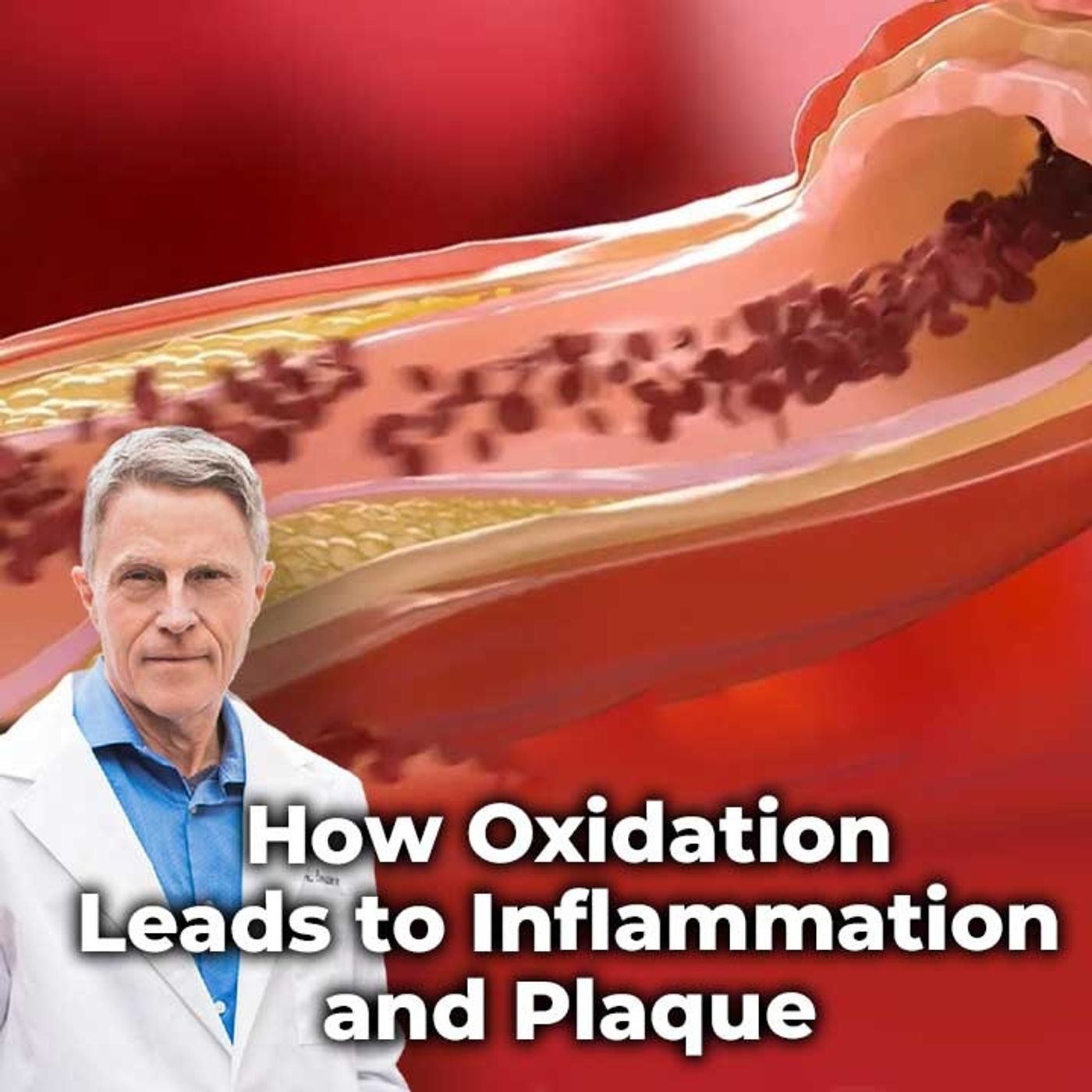 How Oxidation leads to Inflammation and Plaque - FORD BREWER MD MPH