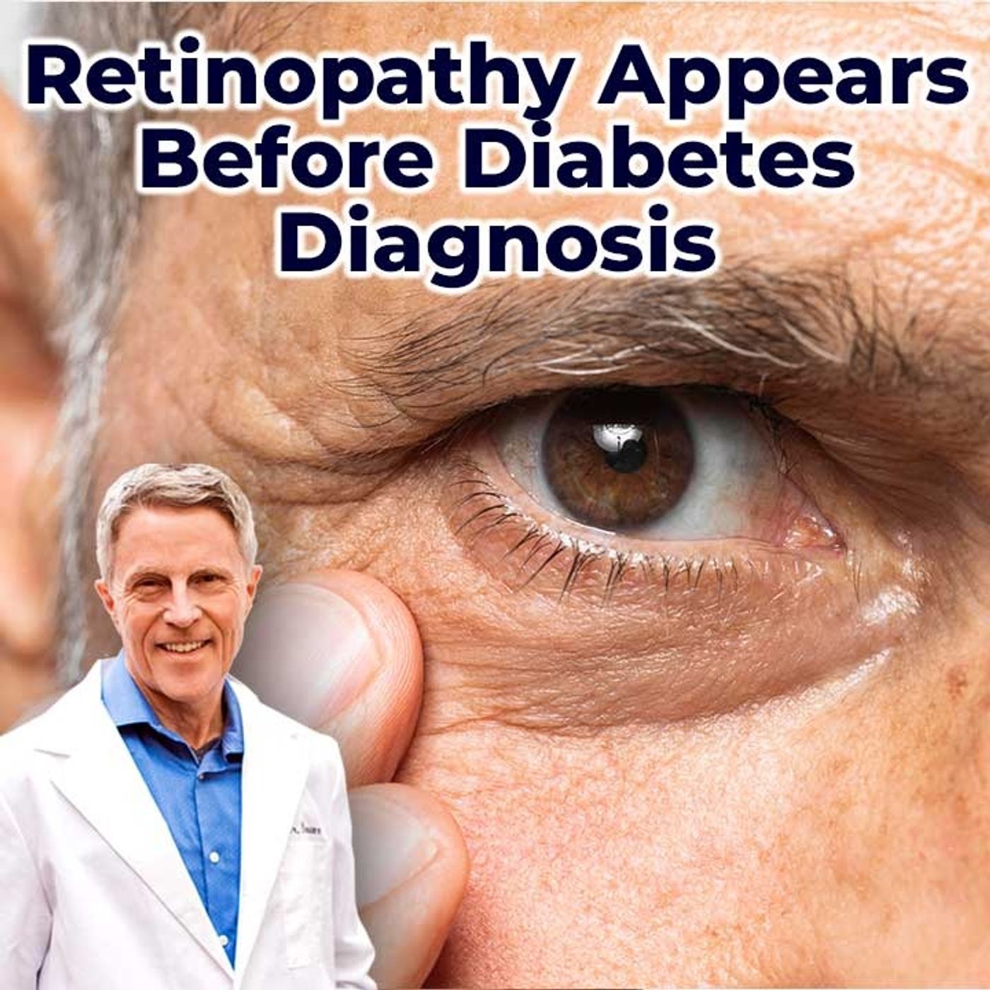 Retinopathy Apears Before Diabetes Diagnosis - FORD BREWER MD MPH