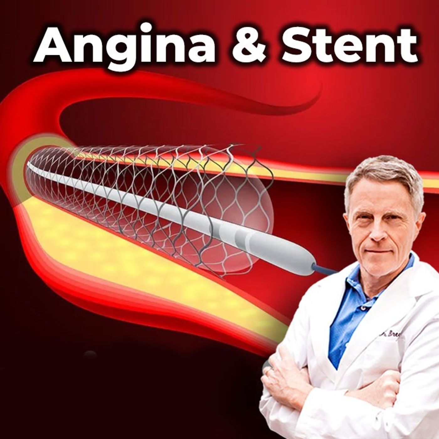 Another Reason Why Stents Don't Work - FORD BREWER MD MPH