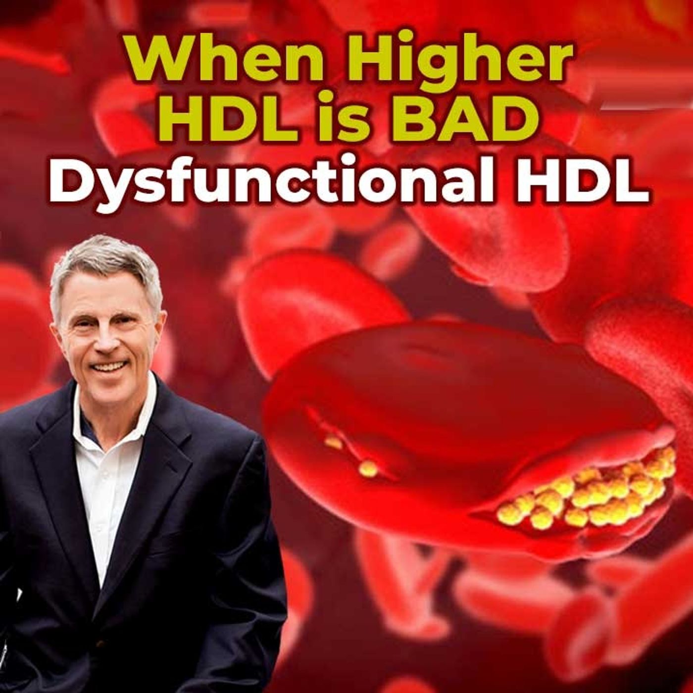 When Higher HDL is BAD - Dysfunctional HDL - FORD BREWER MD MPH
