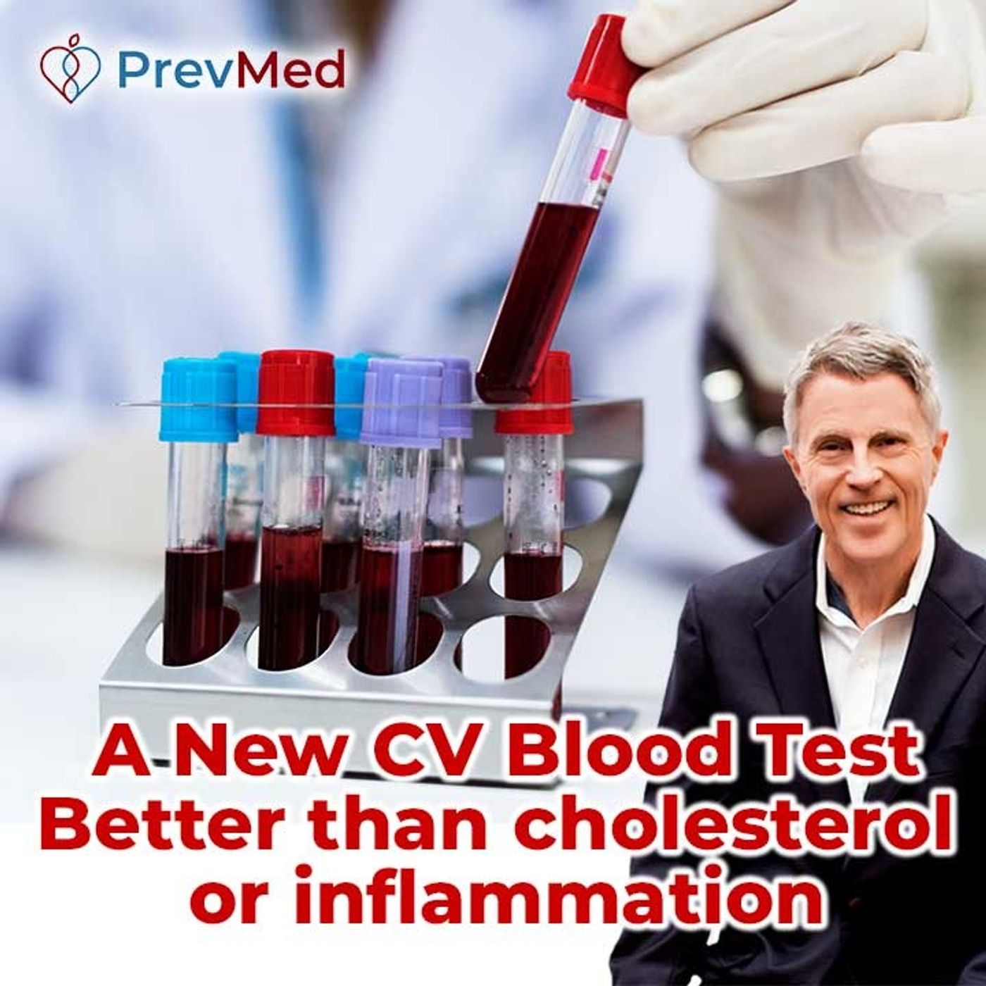 A New CV Blood Test Better than cholesterol or inflammation - FORD BREWER MD MPH