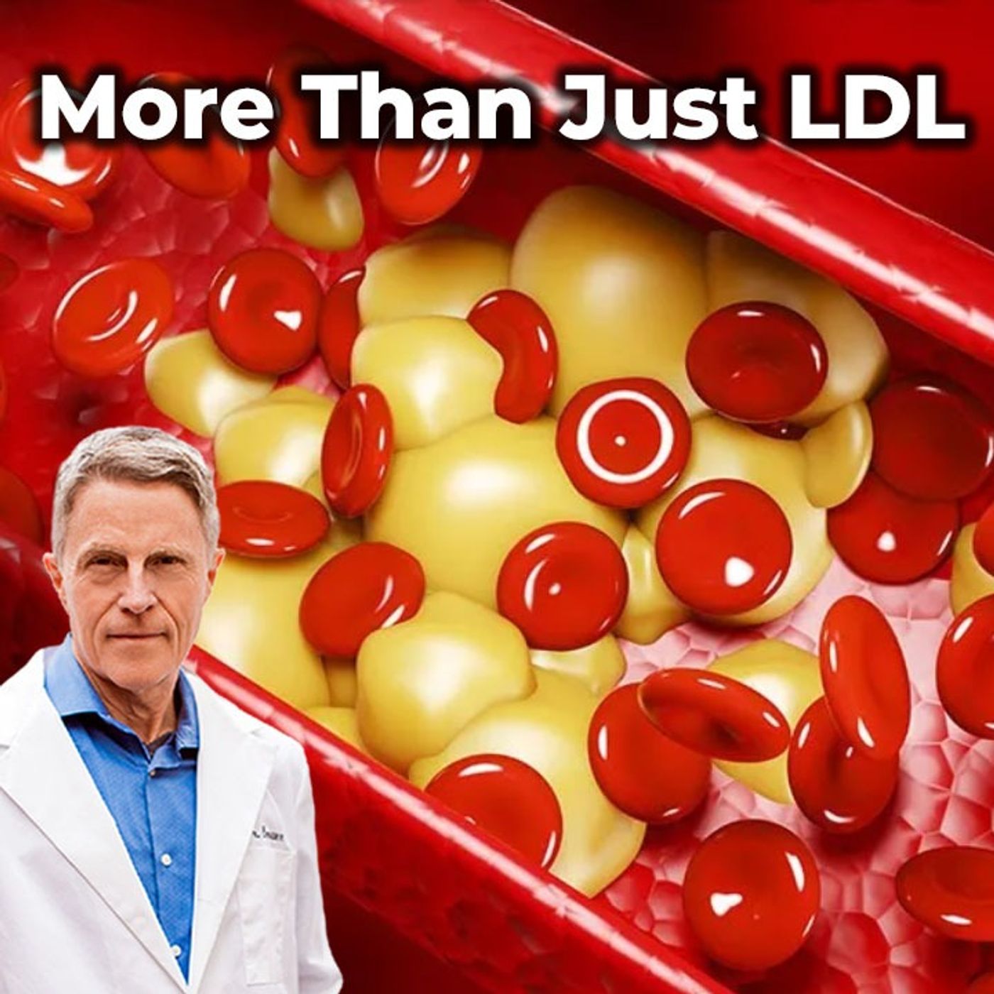 Beyond LDL: The Root Cause of CV Disease - FORD BREWER MD MPH