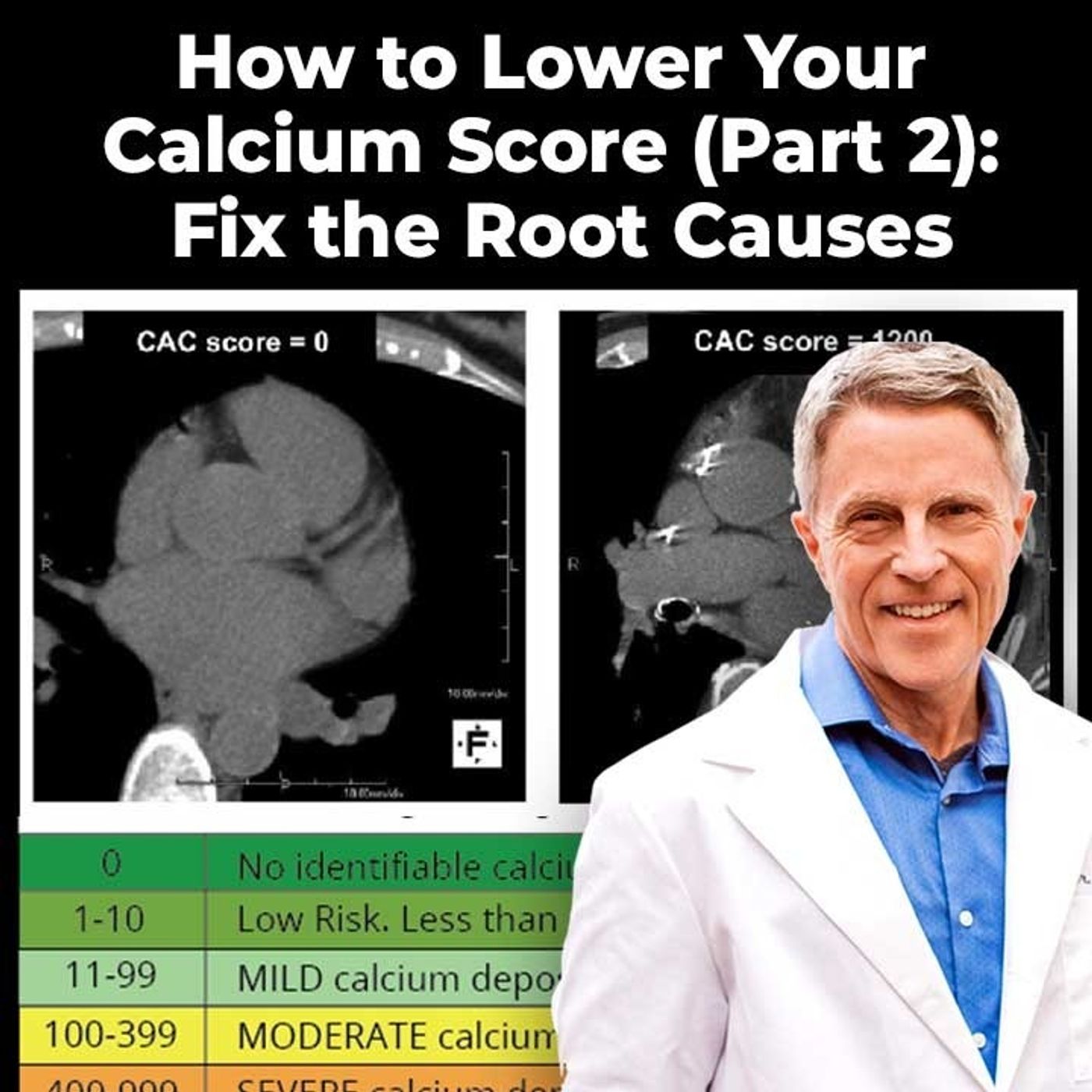 How to Lower Your Calcium Score (Part 2): Fix the Root Causes  - FORD BREWER MD MPH