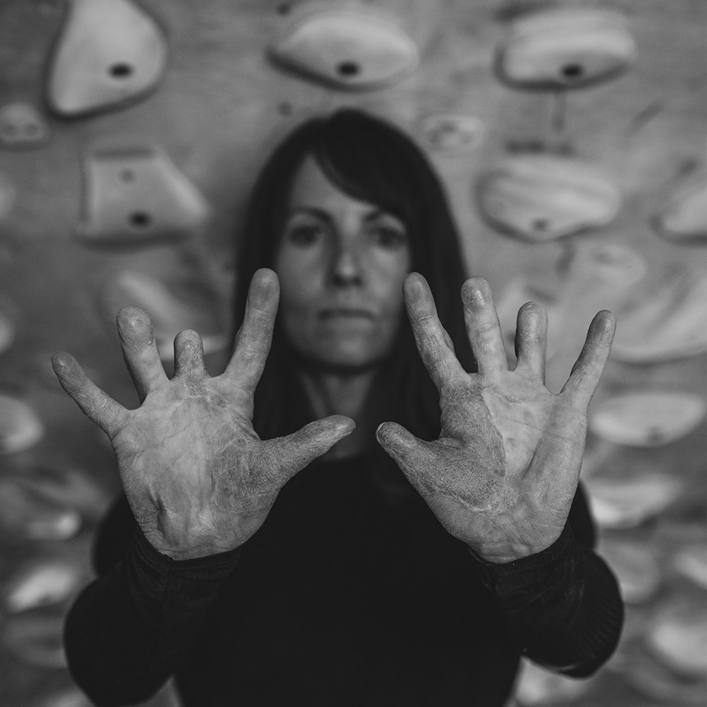 EP 294: Melissa Strong — Dying and Coming Back to Life, Having Her Arms Sewn Together, and Returning to Climbing with 7 ¾ Fingers