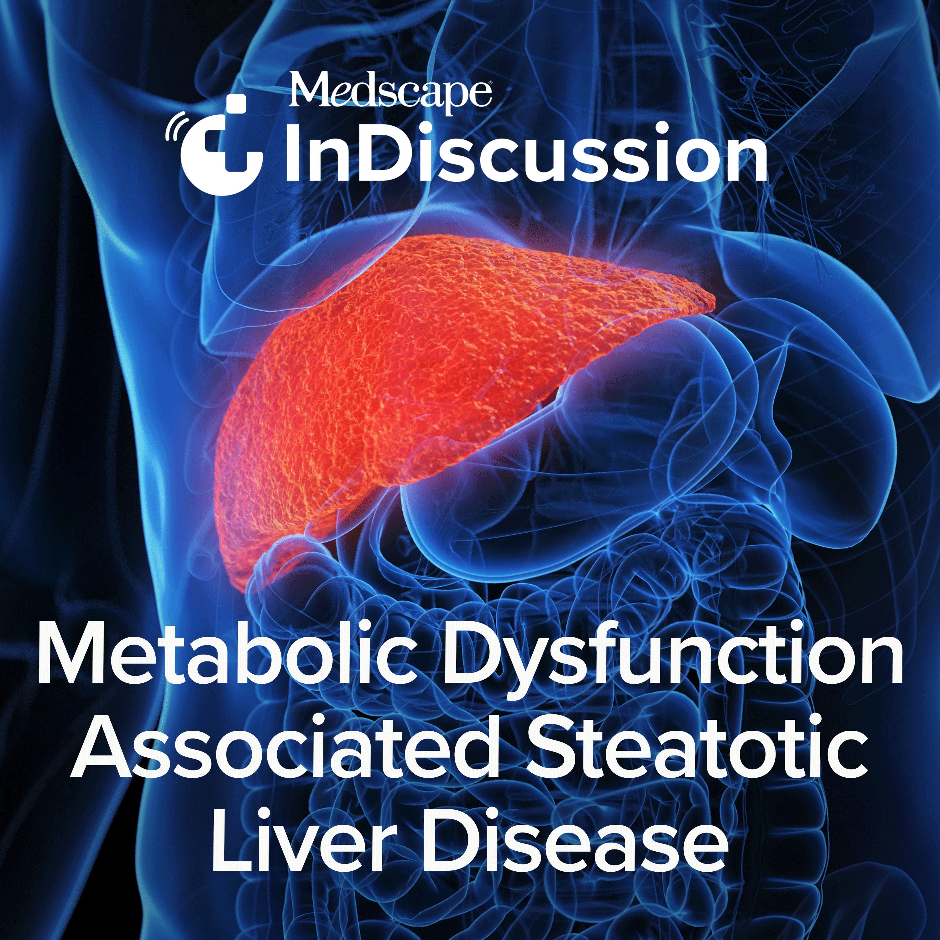 Medscape InDiscussion: MASLD