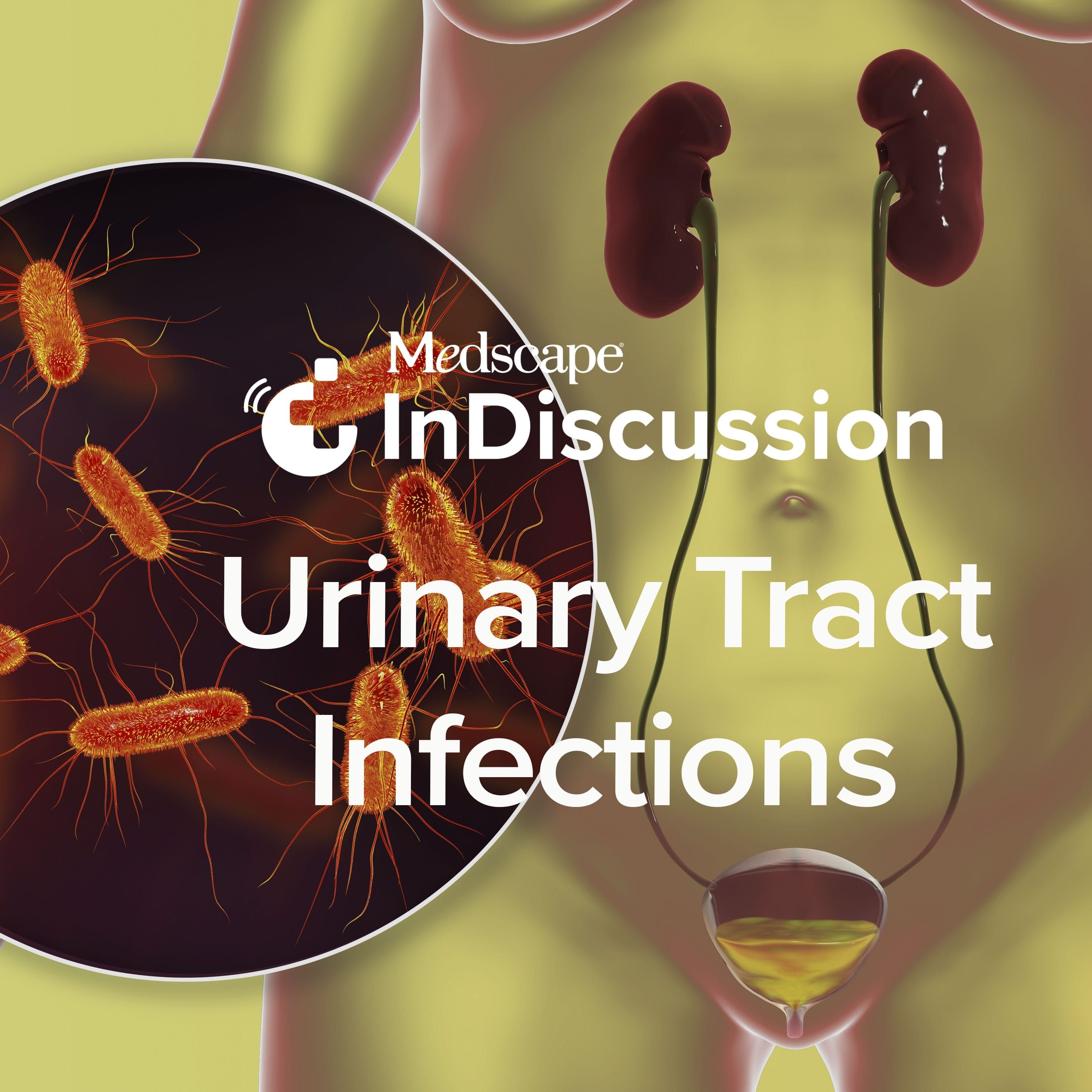 Medscape InDiscussion: Urinary Tract Infections