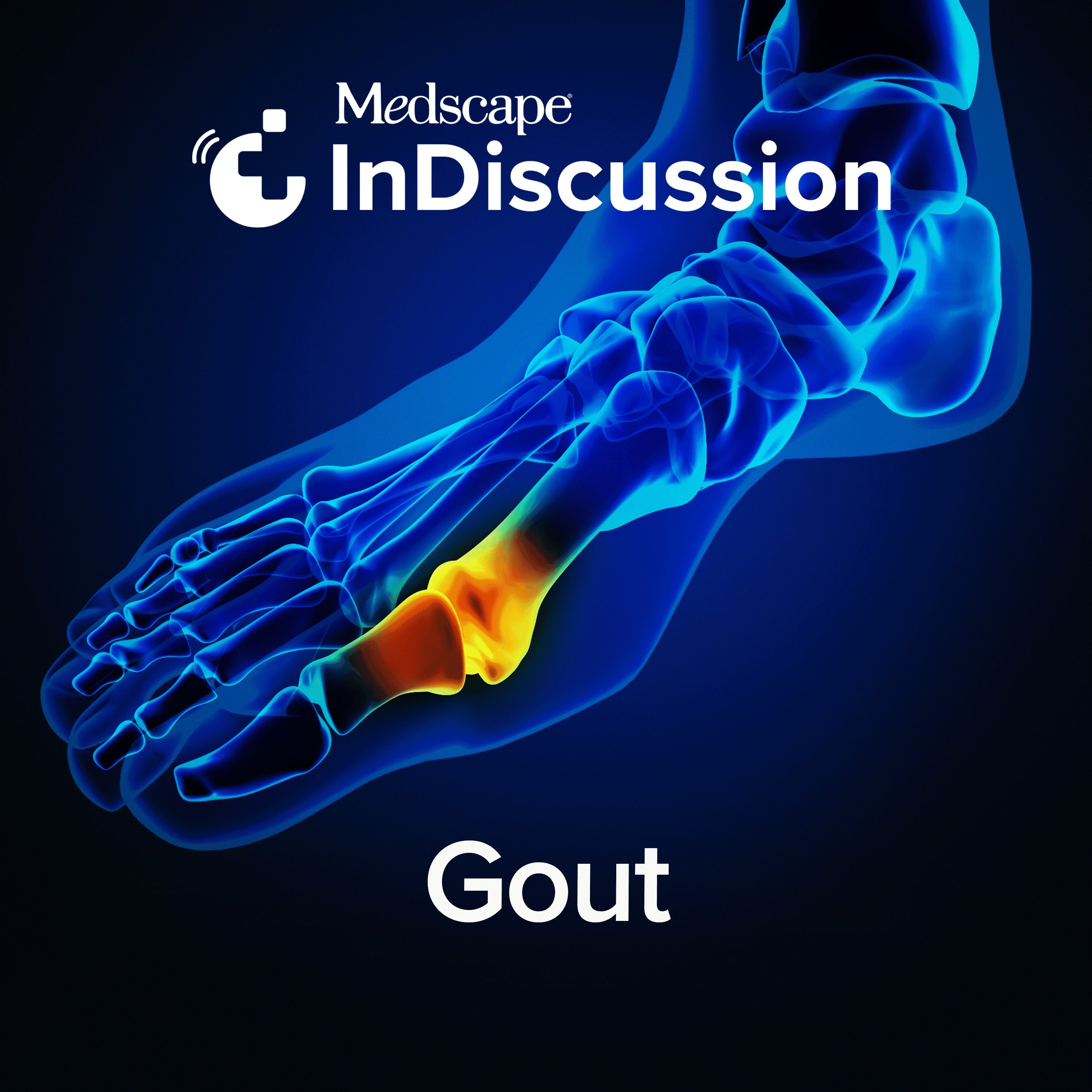 Medscape InDiscussion: Gout