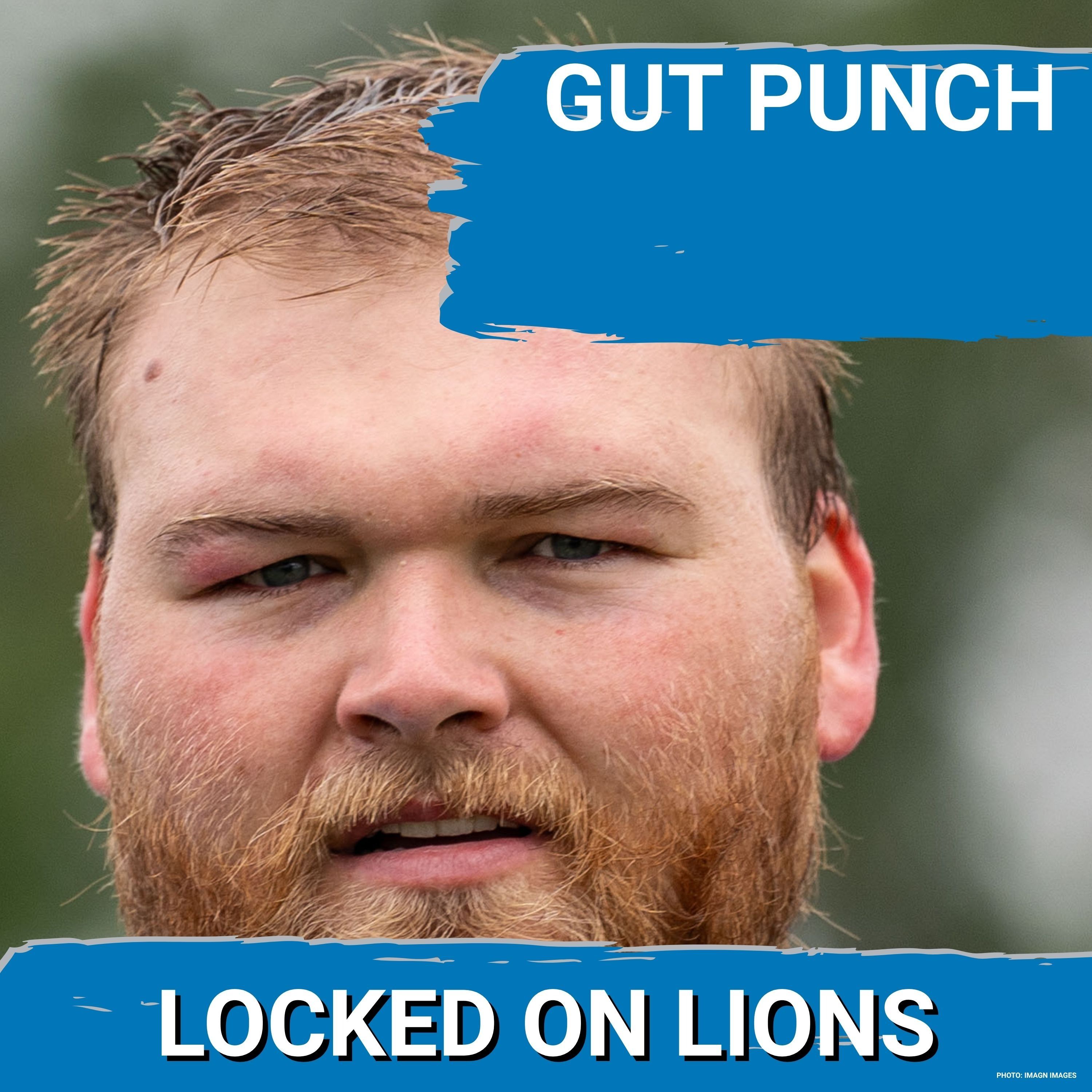 EMERGENCY: Detroit Lions’ Cade Mays Suffers Injury—OFFENSE Faces Critical Early SETBACK. episode artwork