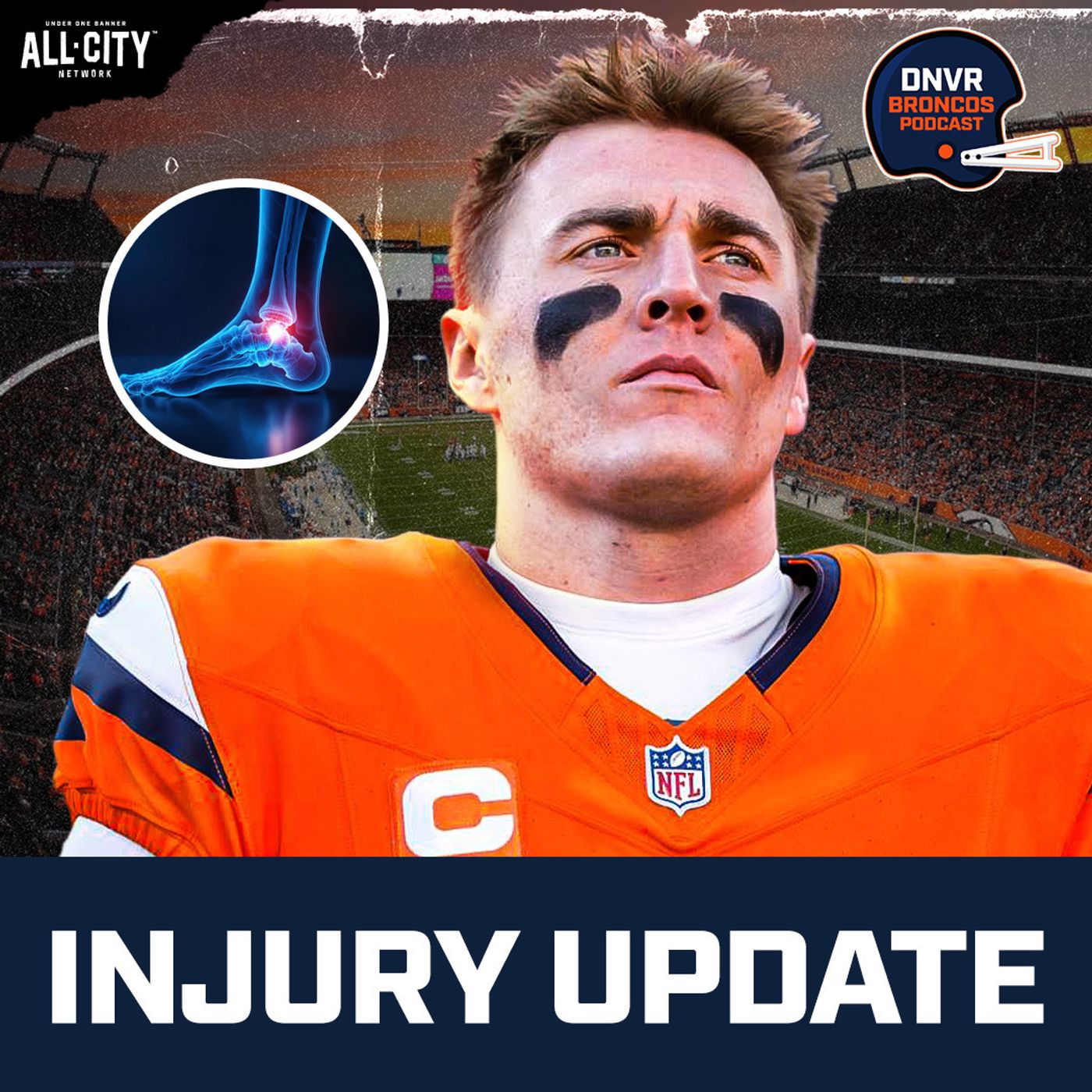 What to make of Bo Nix's followup procedure & breaking down the Denver Broncos draft Brian Baldinger episode artwork