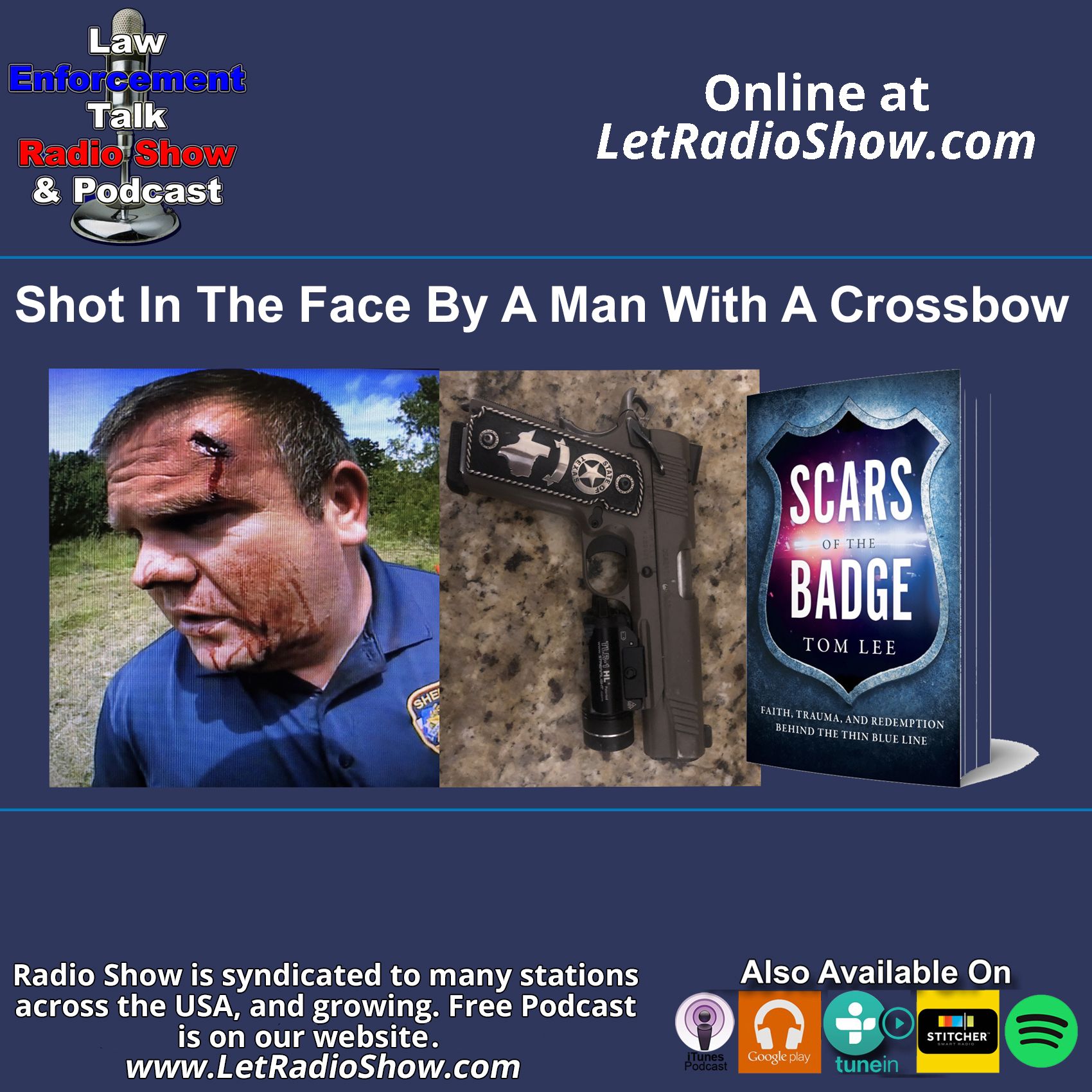 Shot in the Face by a Man With a Crossbow