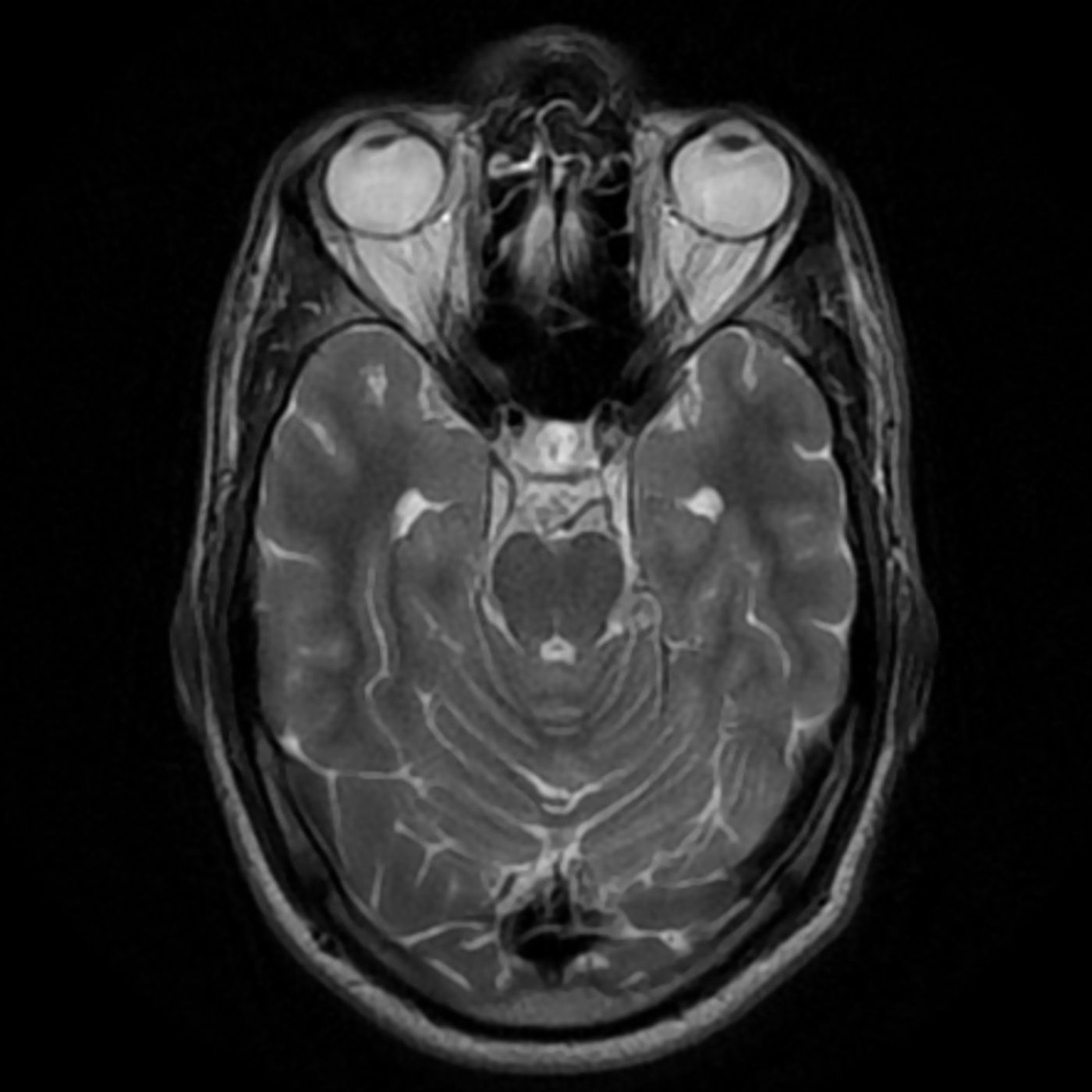 A Brain Health Challenge for 2026 A Brain Health Challenge for 2026