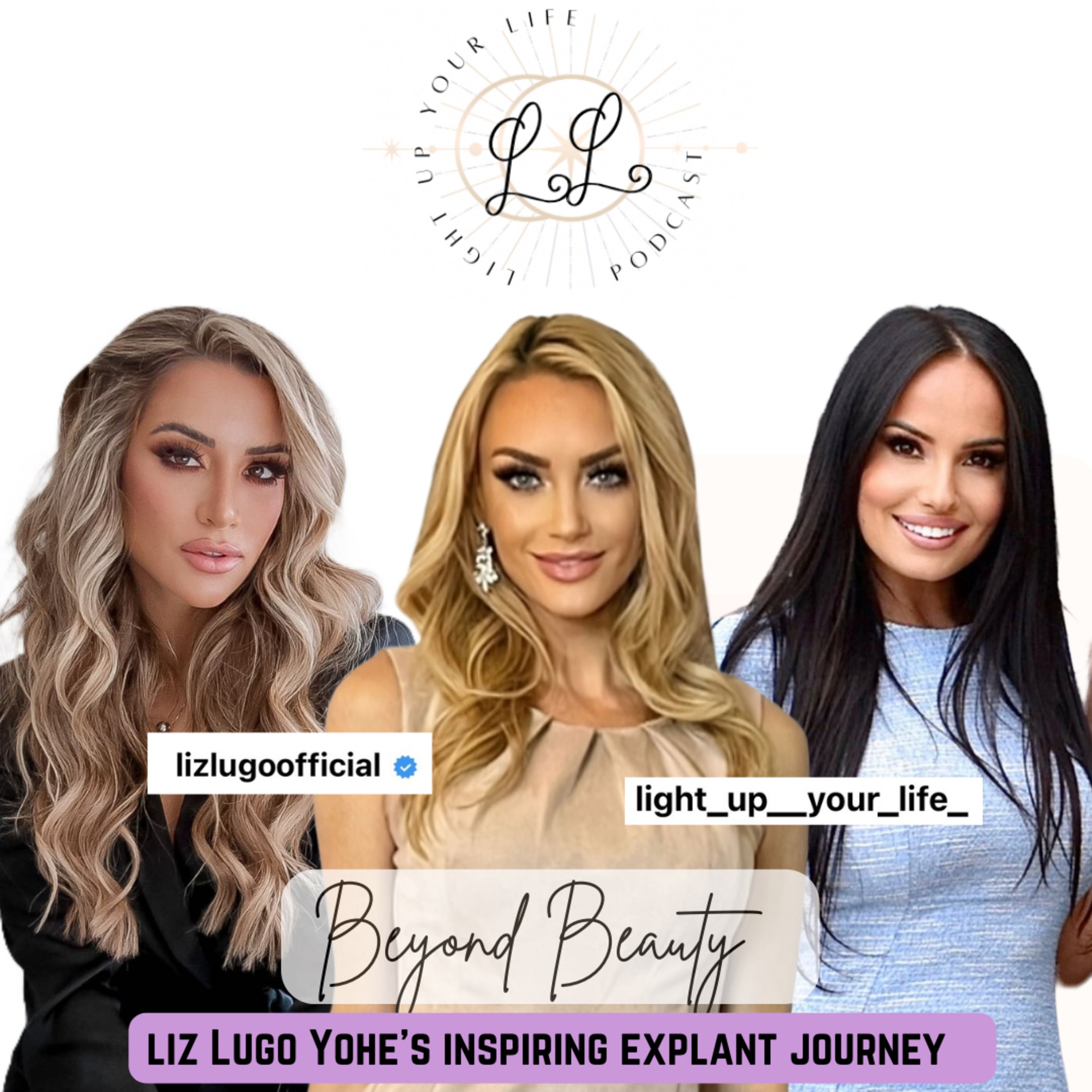 Beyond Beauty: Liz Lugo Yohe's Inspiring Explant Journey episode artwork