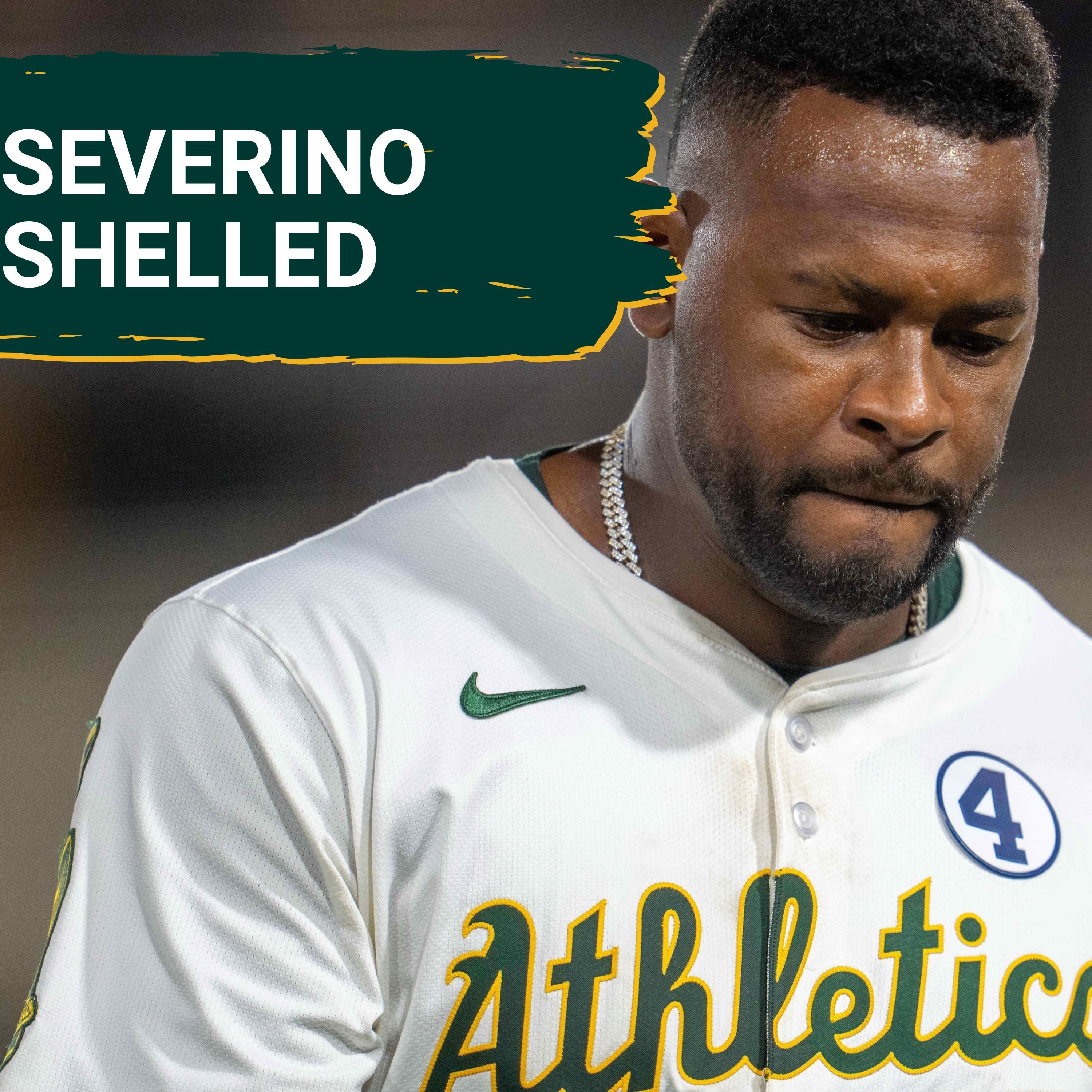 SEVERINO SHELLED: Yankees Bury Uninspired A's Team in Series Finale