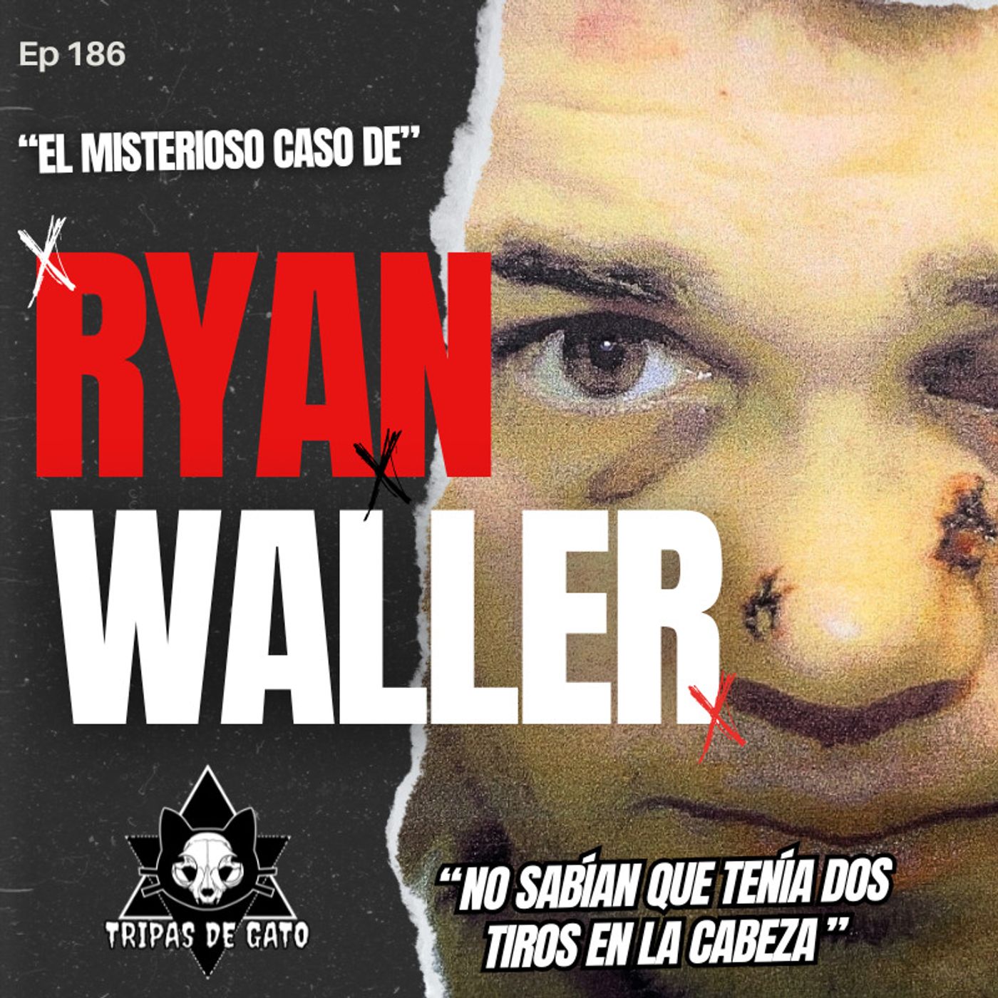 Ep 186 "El Caso de Ryan Waller | No Sabía que tenía Dos Balas en el Cerebro"