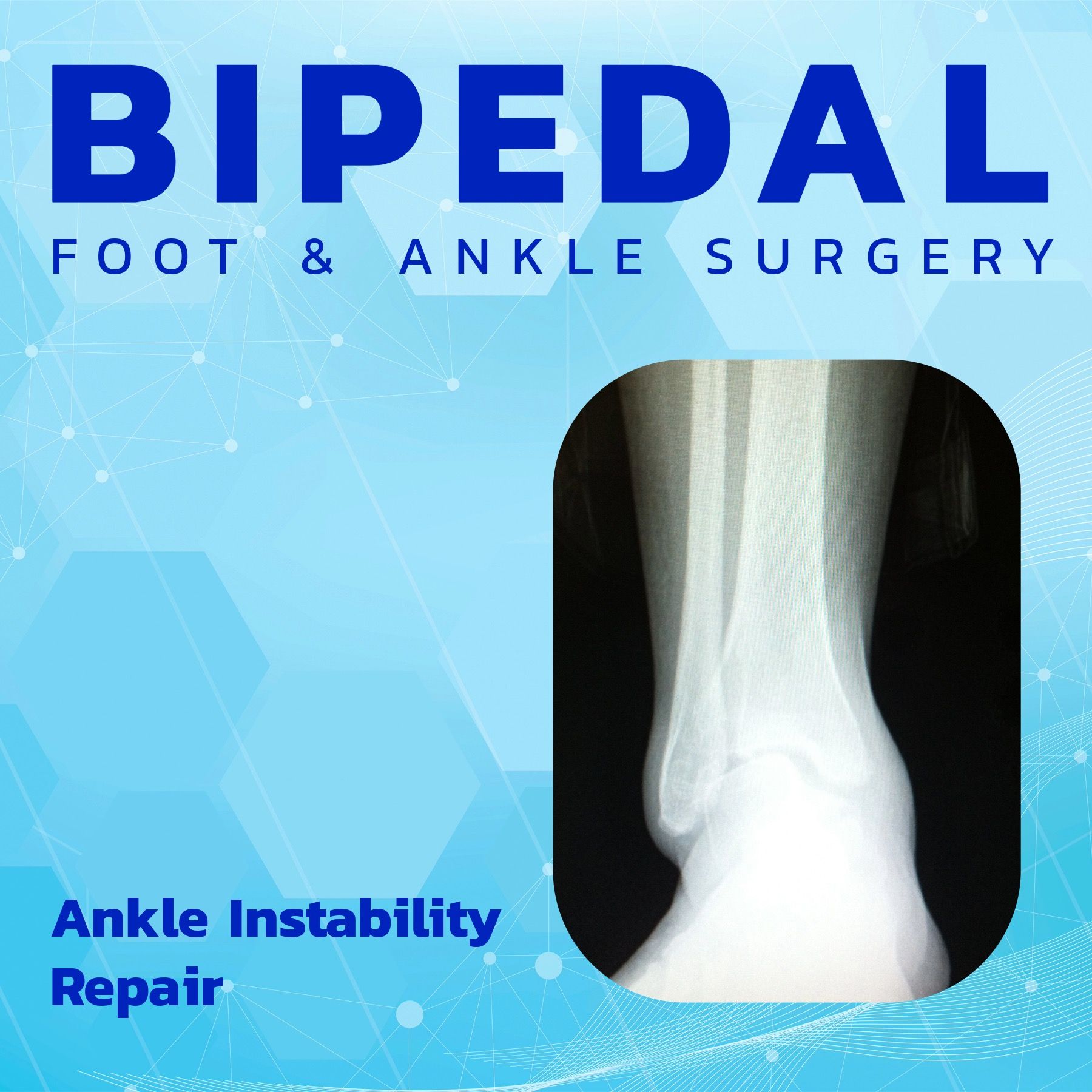 Ankle Instability and Reconstruction episode artwork