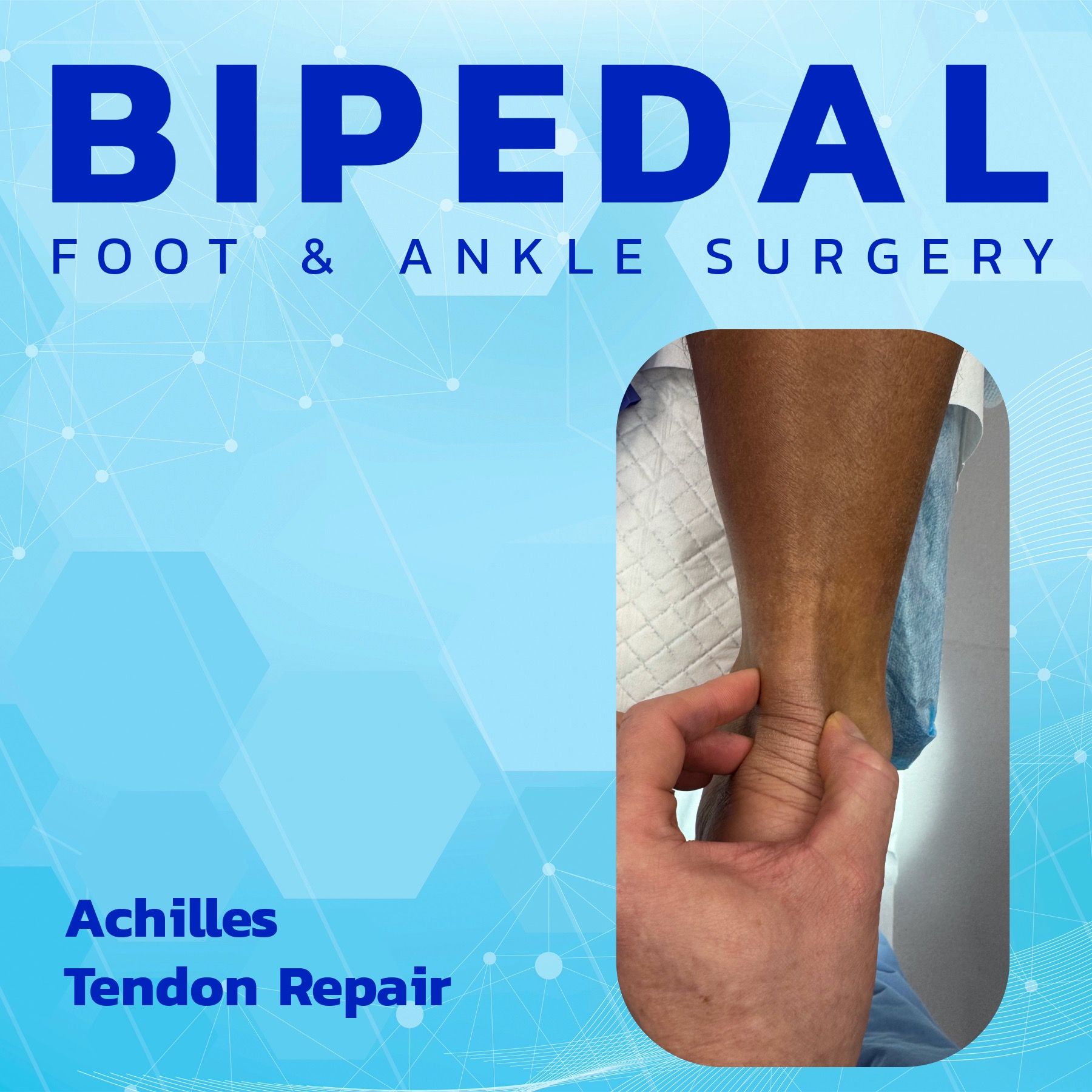 Achilles Tendon Repair Rehabilitation episode artwork