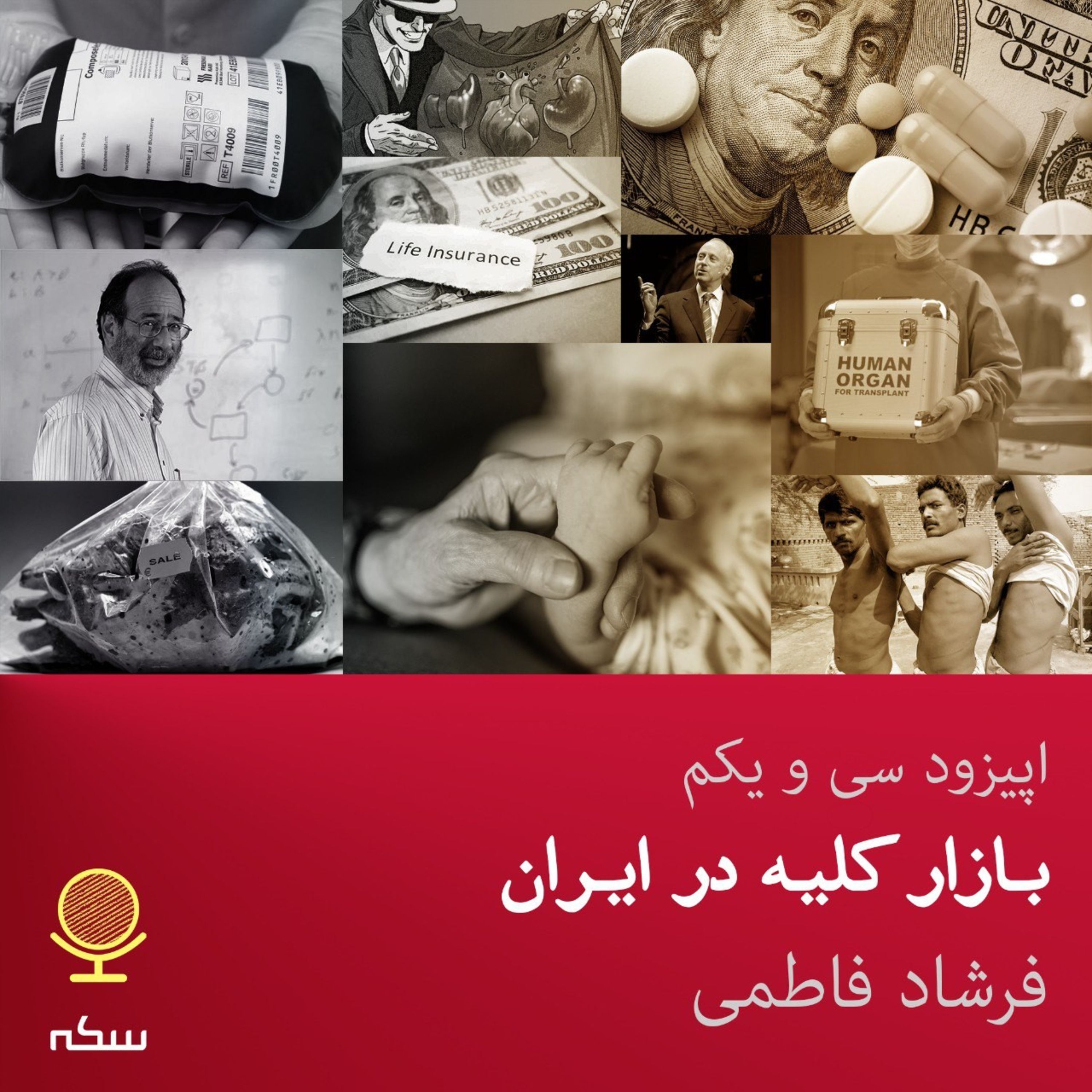 ۳۱: بازار کلیه در ایران