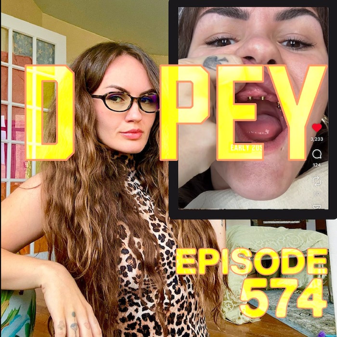 Dopey 574 episode art