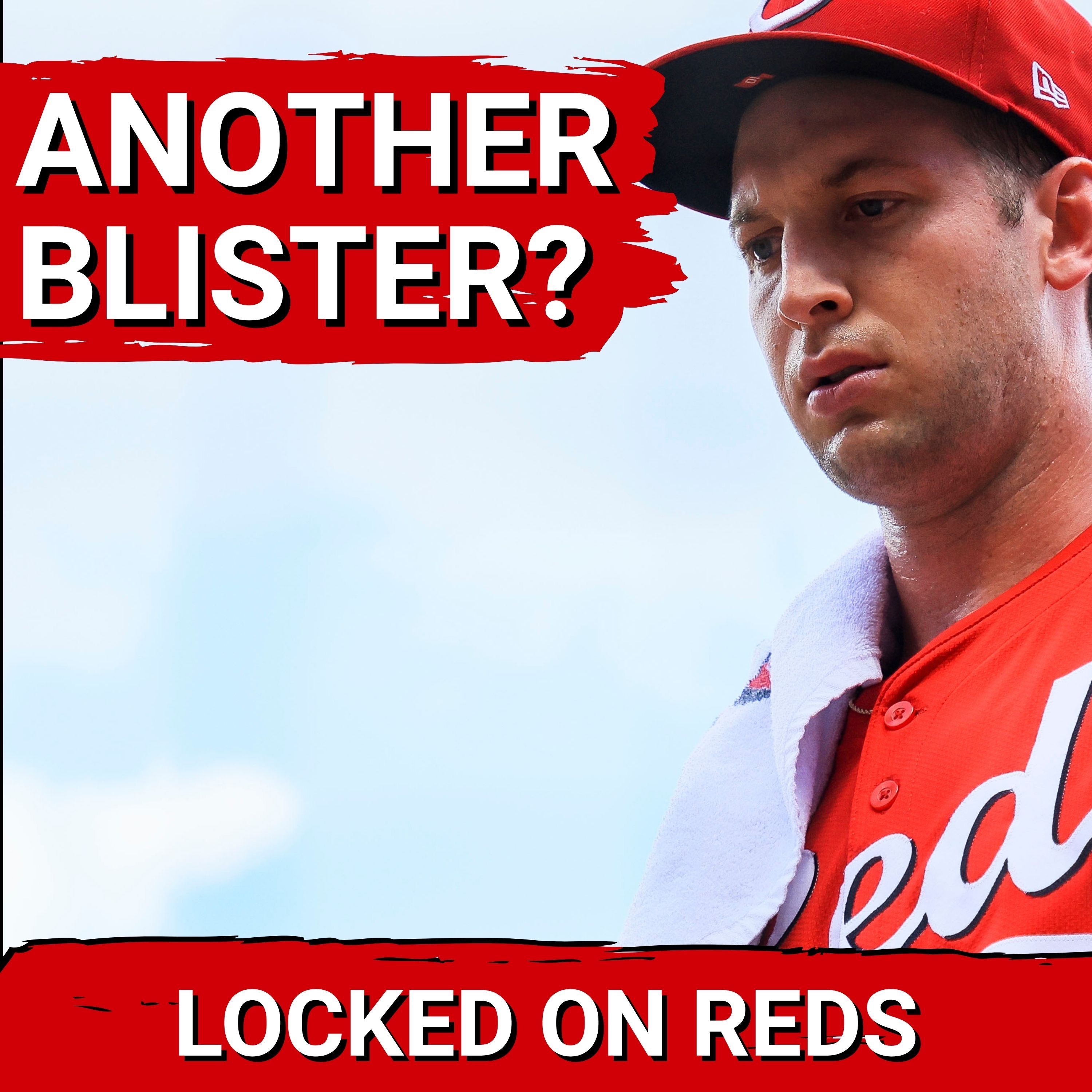 CRISIS: Cincinnati Reds Must SOLVE Nick Lodolo Blister Woes or RISK Losing Ace for Good episode artwork