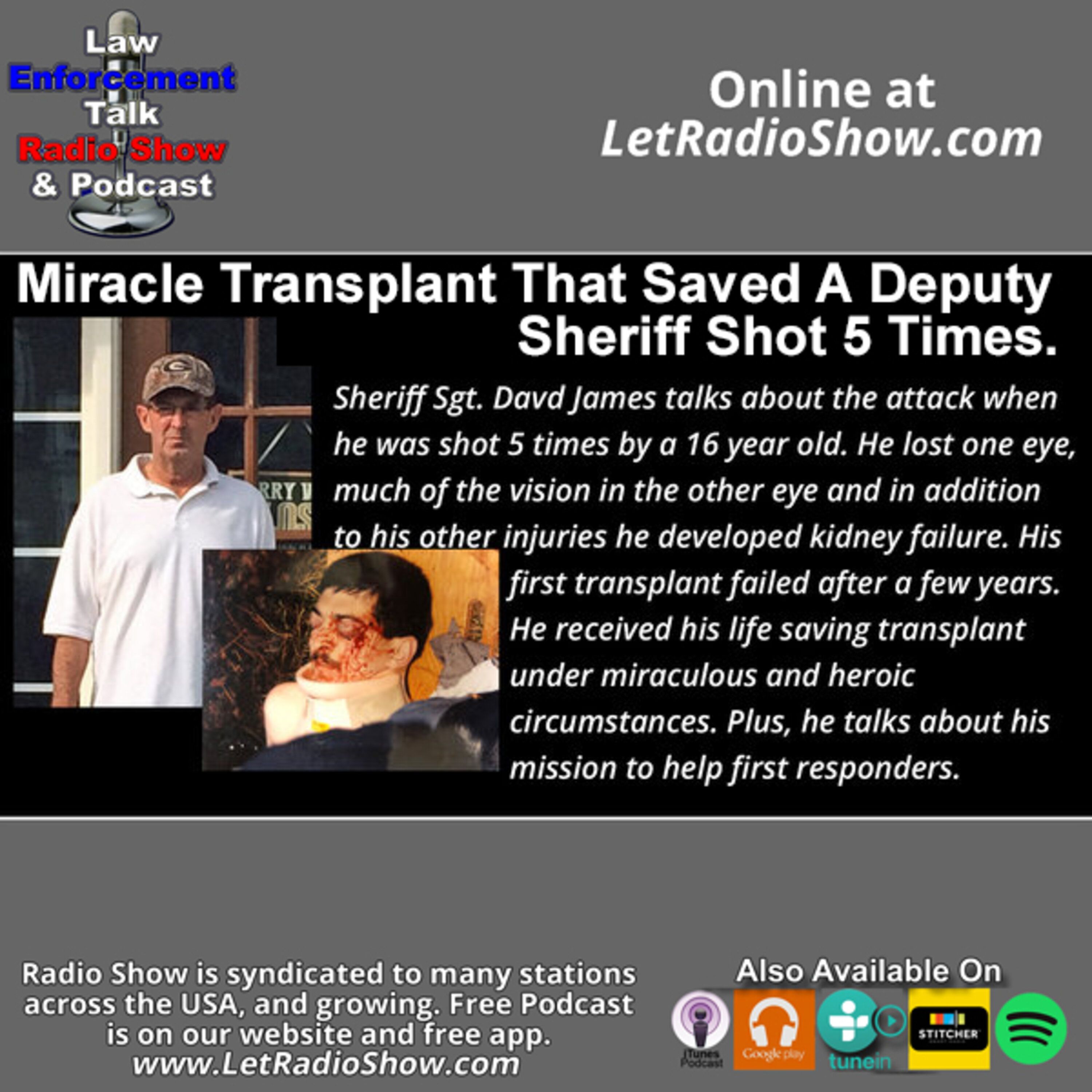 Deputy Shot Miracle Needed after Shot 5 Times. Special Episode Deputy Shot Miracle Needed after Shot 5 Times. Special Episode