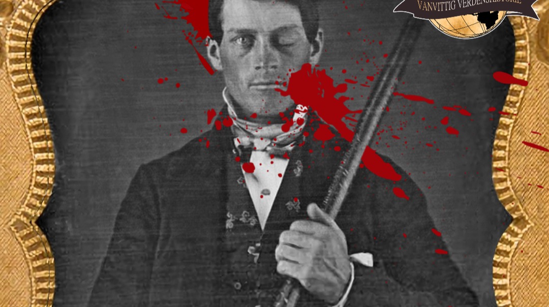 #187: Phineas Gage: Helt Hul i Hovedet!?
