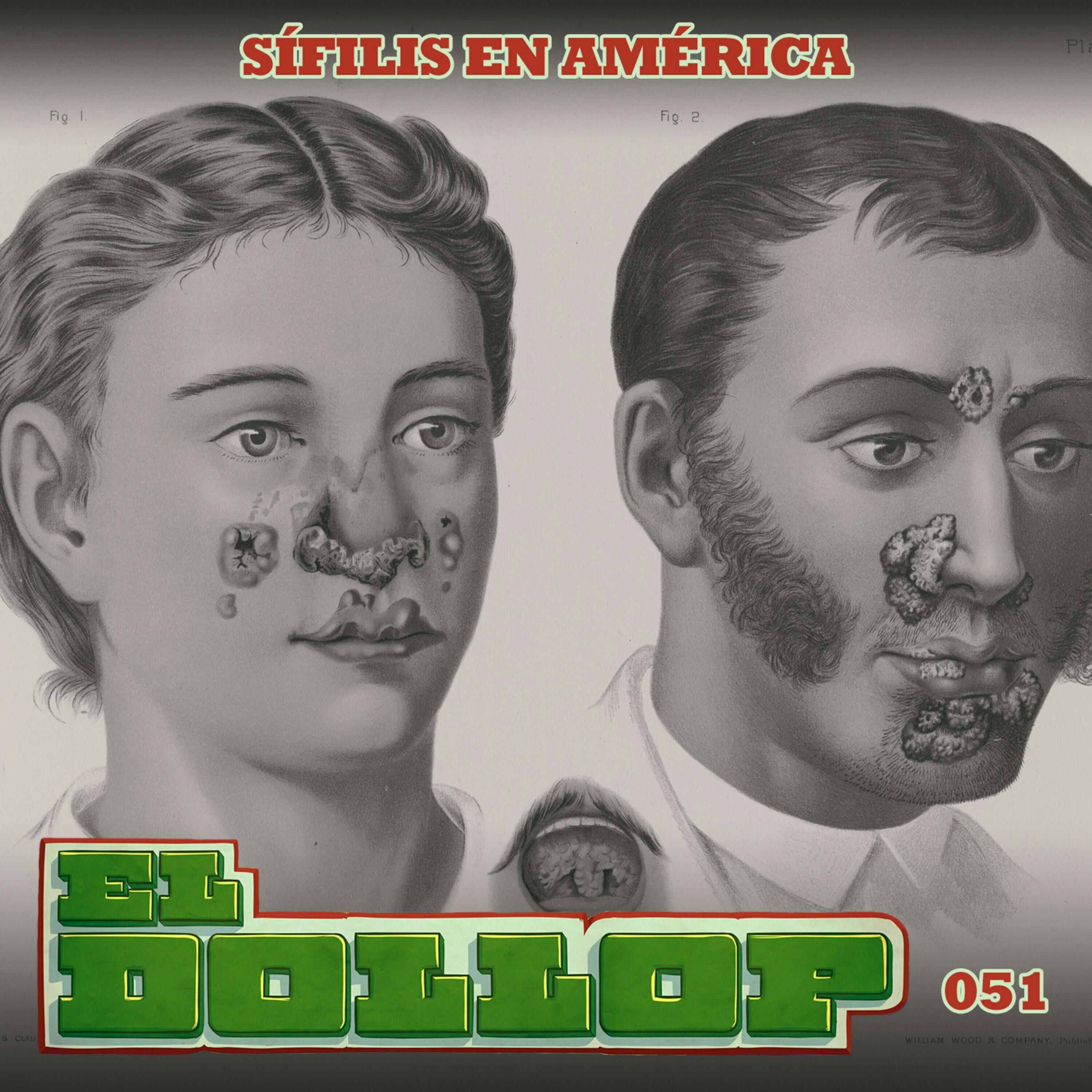 El Dollop 051: Sífilis en América