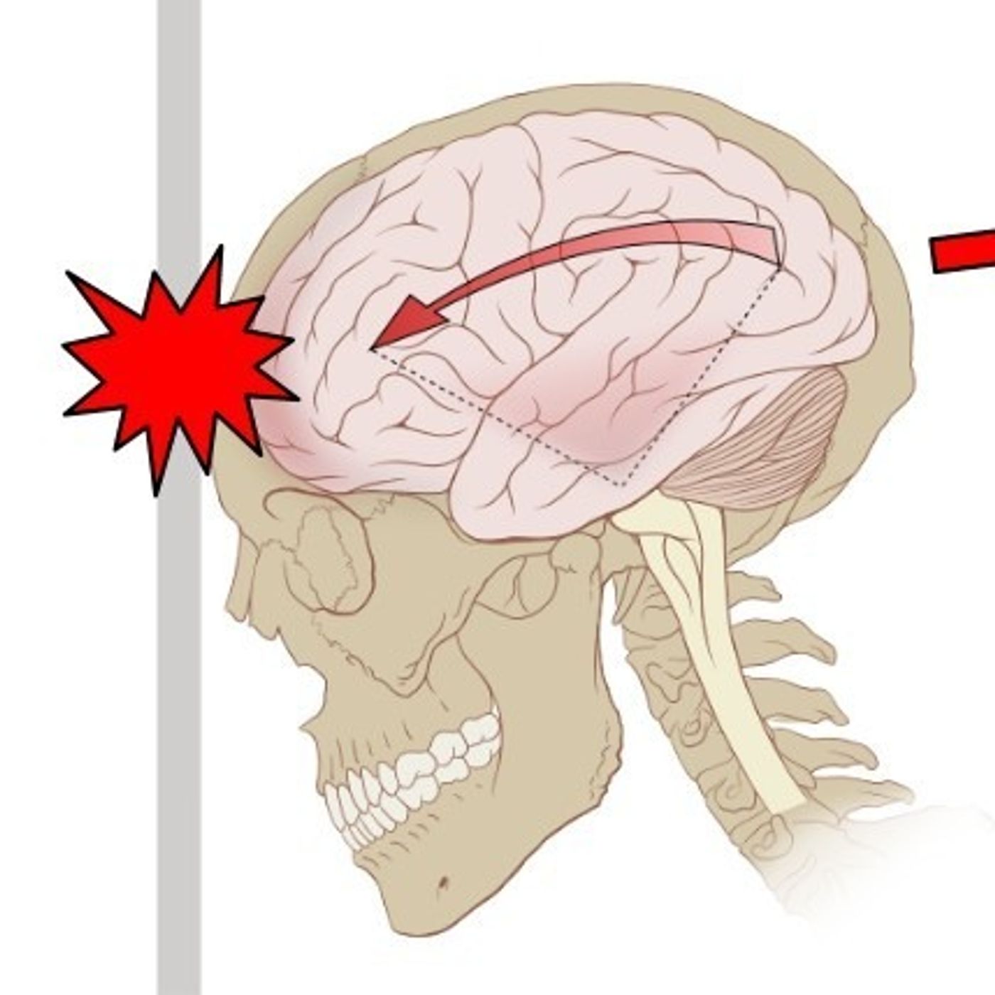 A Breakthrough in Studying Diseases of the Brain
