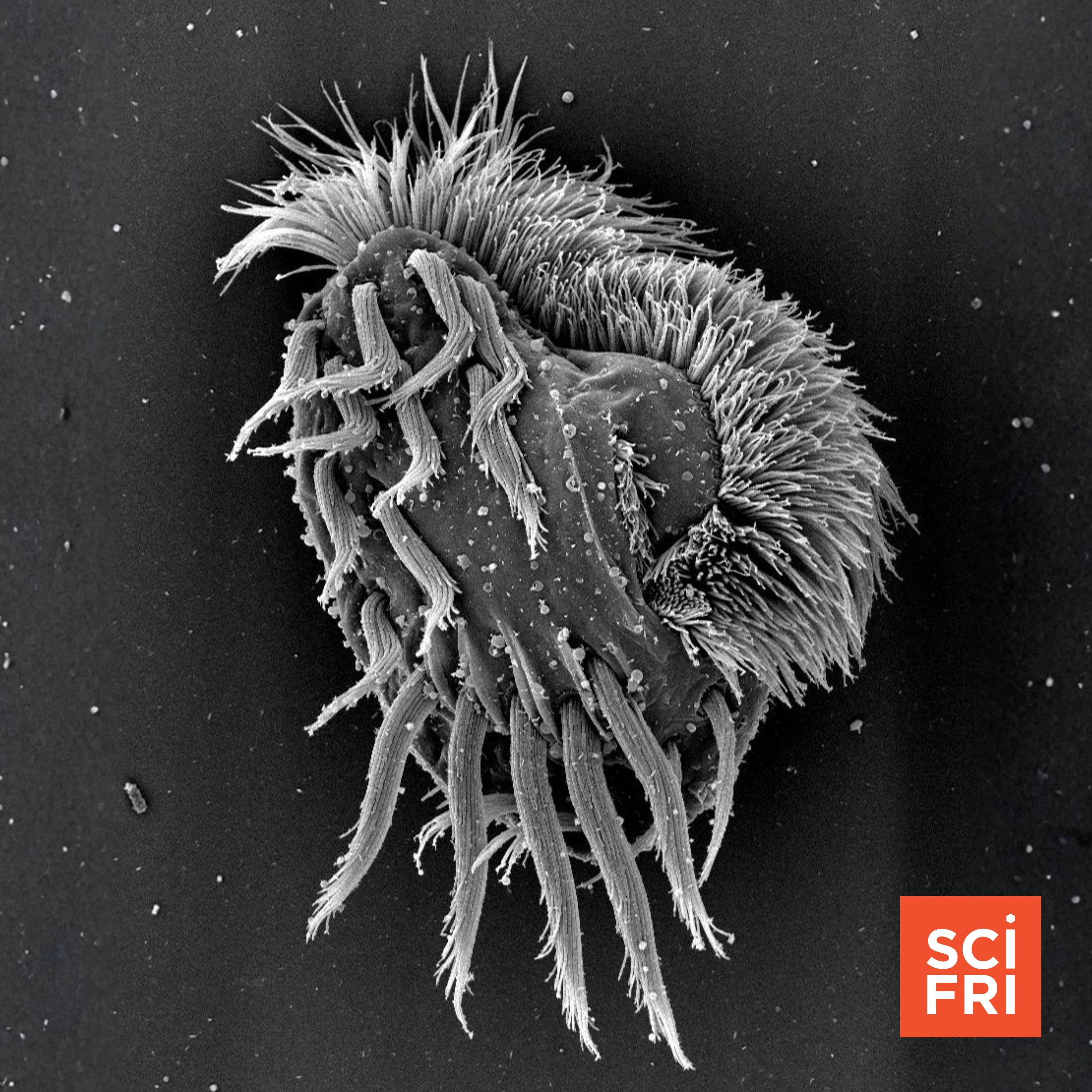 Swords, cannibalism, poison: inside the world of killer microbes episode artwork