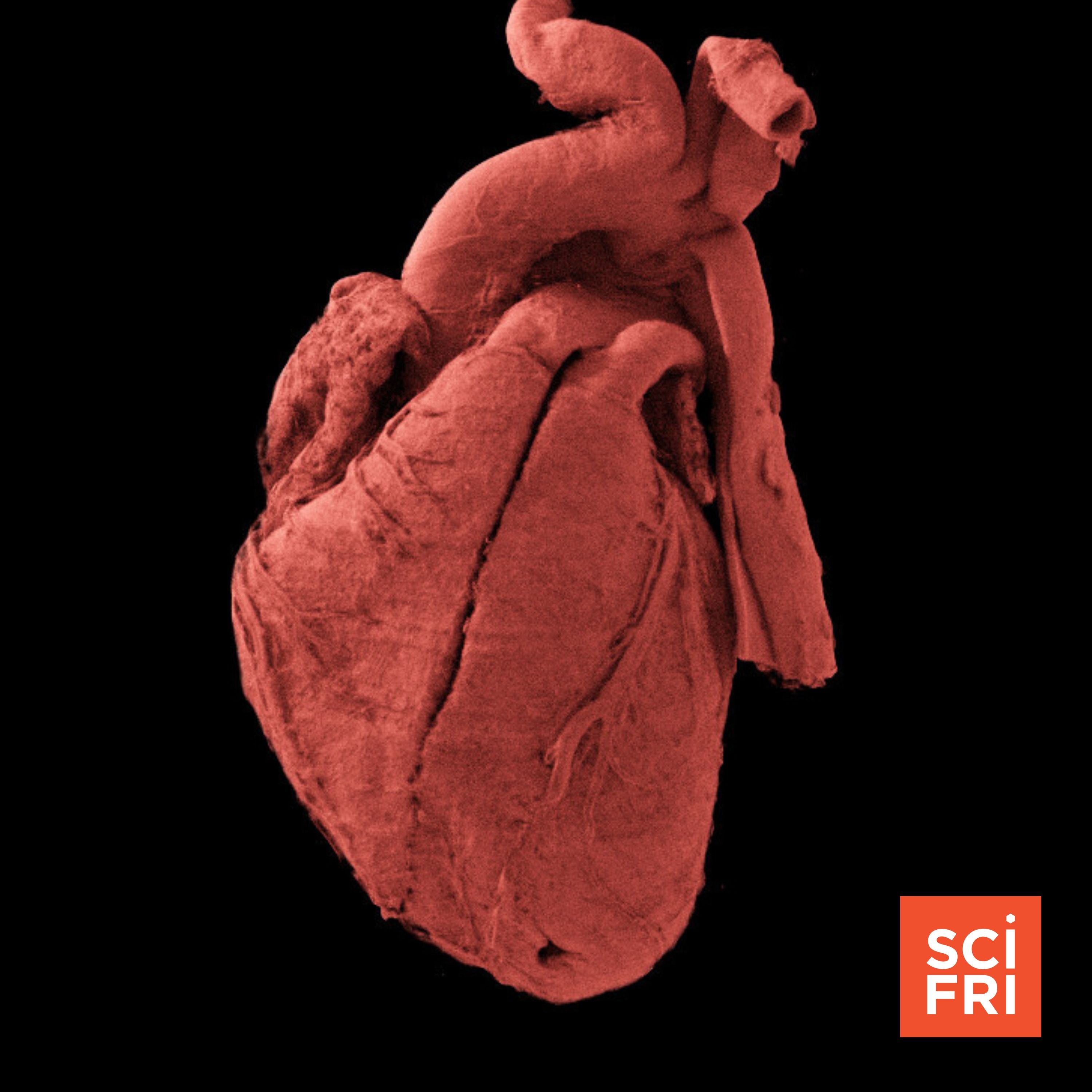 How a particle accelerator illuminated 56 human organs