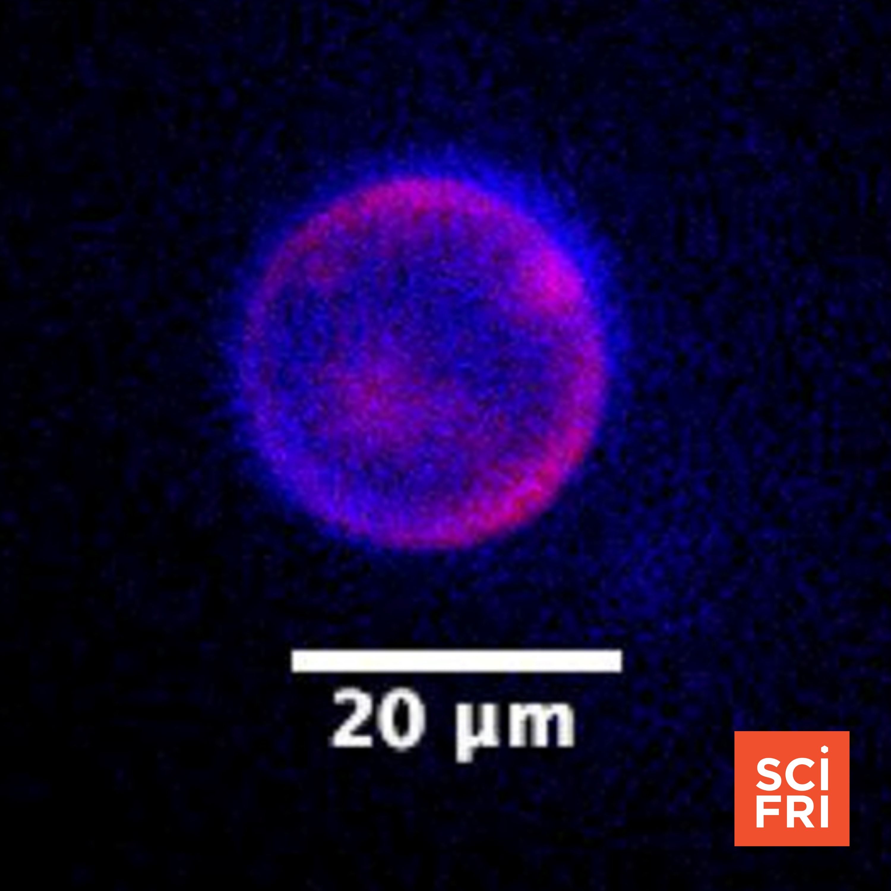 An artificial cell eats, grows, and reproduces. Is it alive? podcast